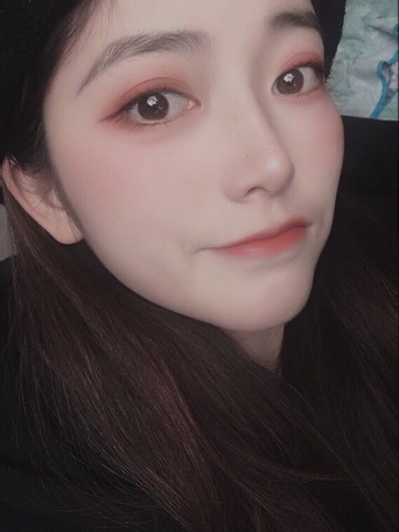 选择这家医院绝对是我今生最大的福气了,双眼皮大眼睛_圈子-新氧美容