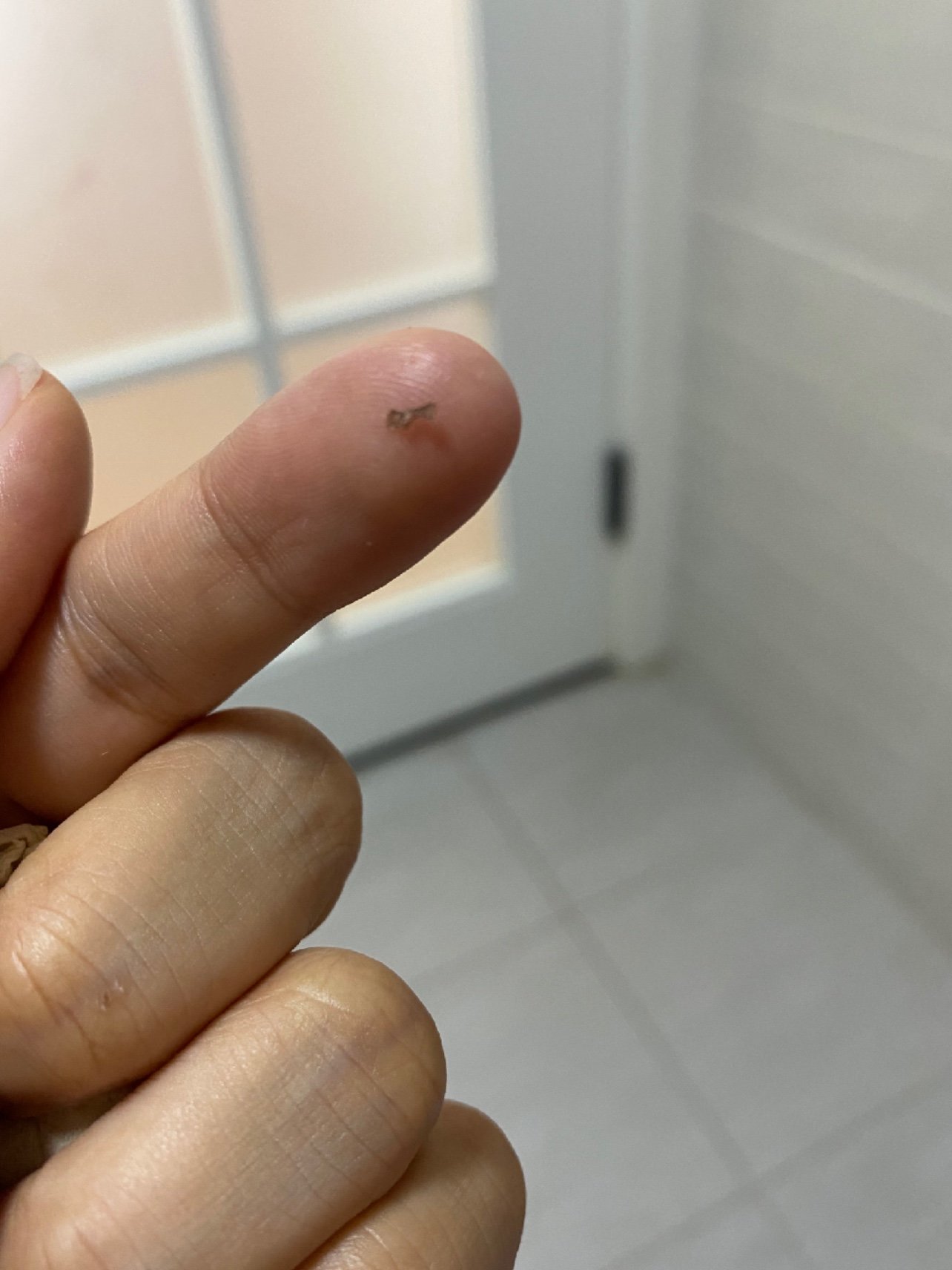 今天脸上的爆破点已经开始结痂脱落了,掉下来的痂是这个样子的