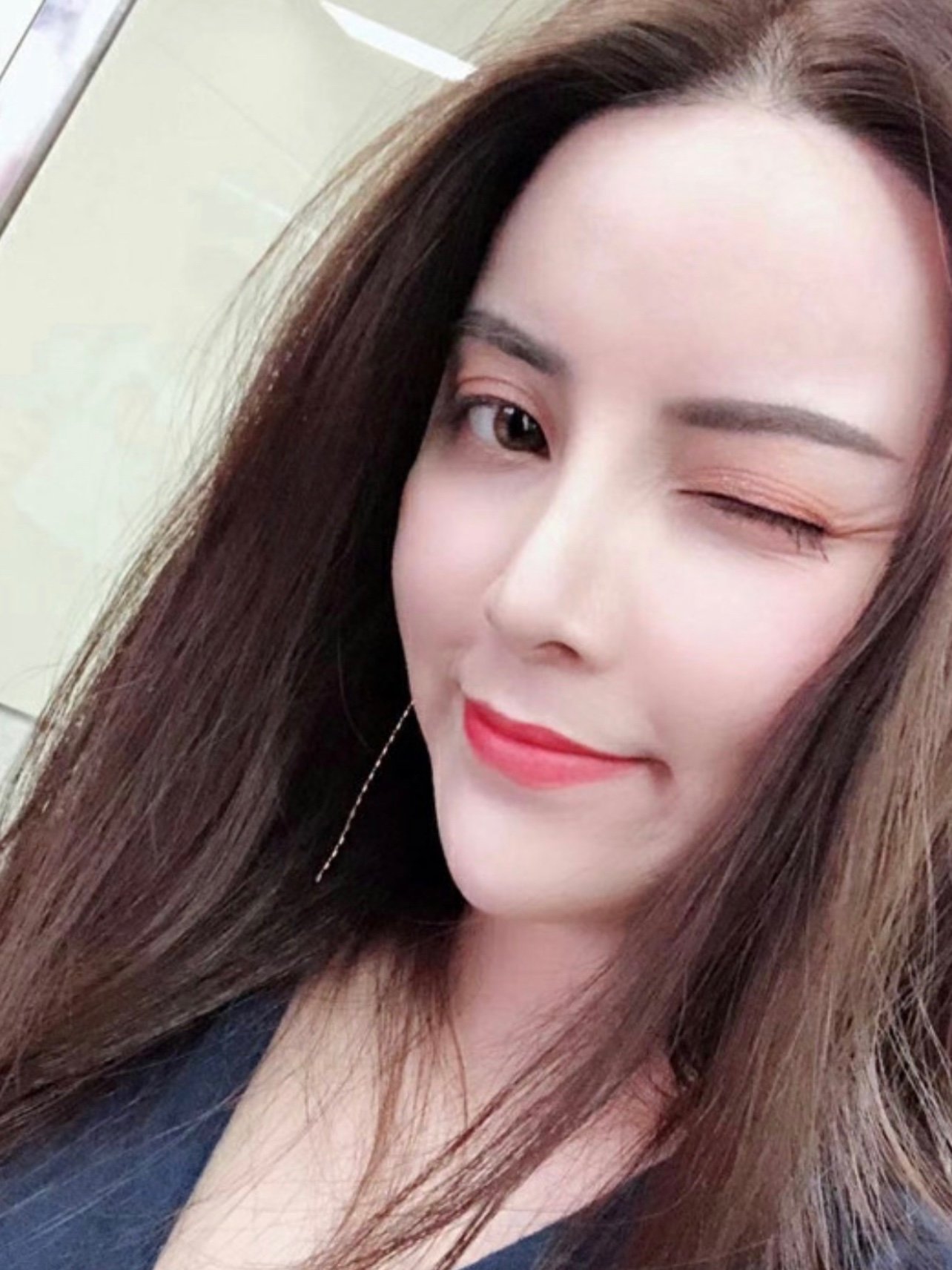 一个高挺漂亮的鼻子就能帮你撑起80%的颜值.鼻子位_圈子-新氧美容整形