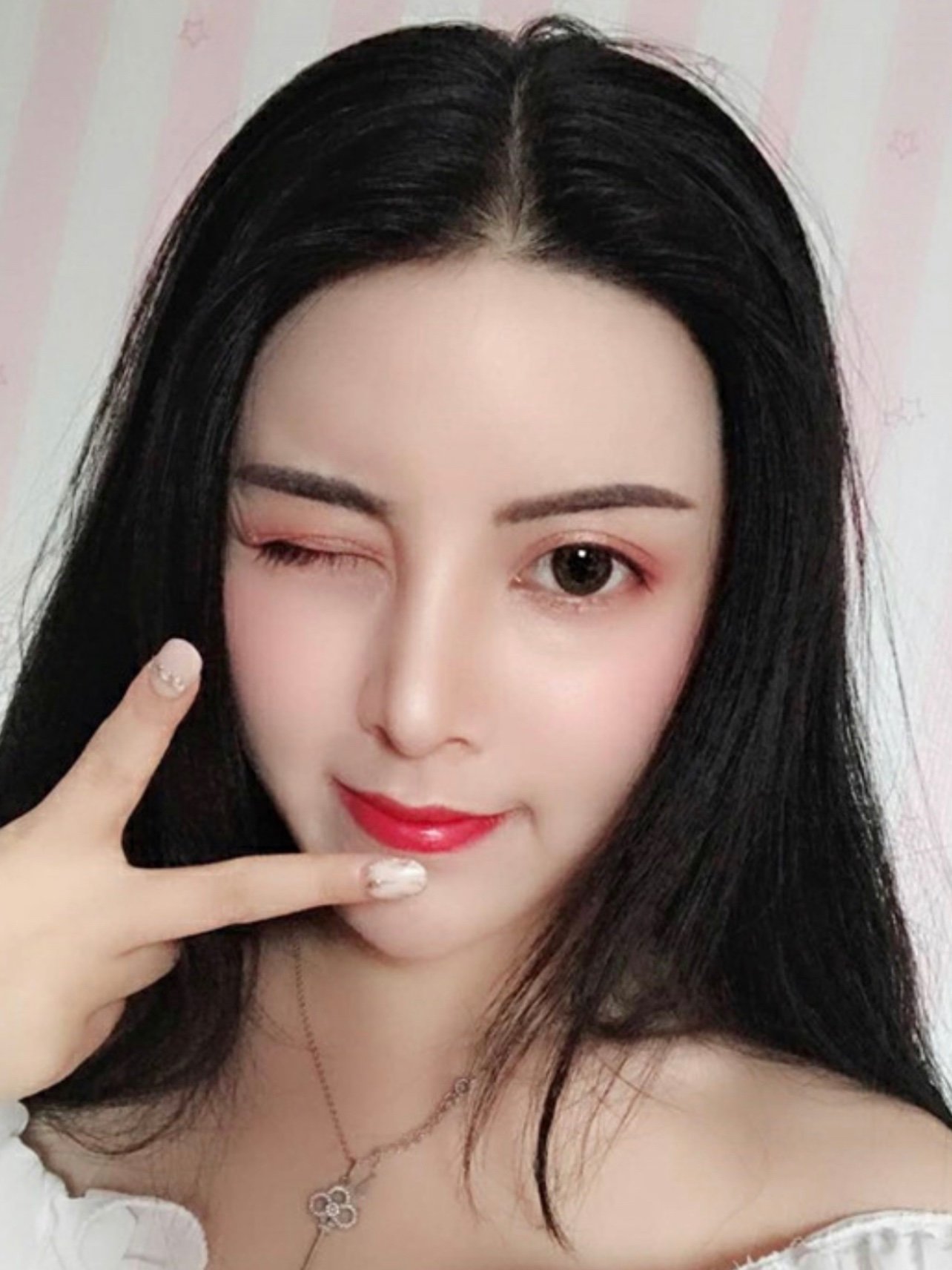 一个高挺漂亮的鼻子就能帮你撑起80%的颜值.鼻子位_圈子-新氧美容整形