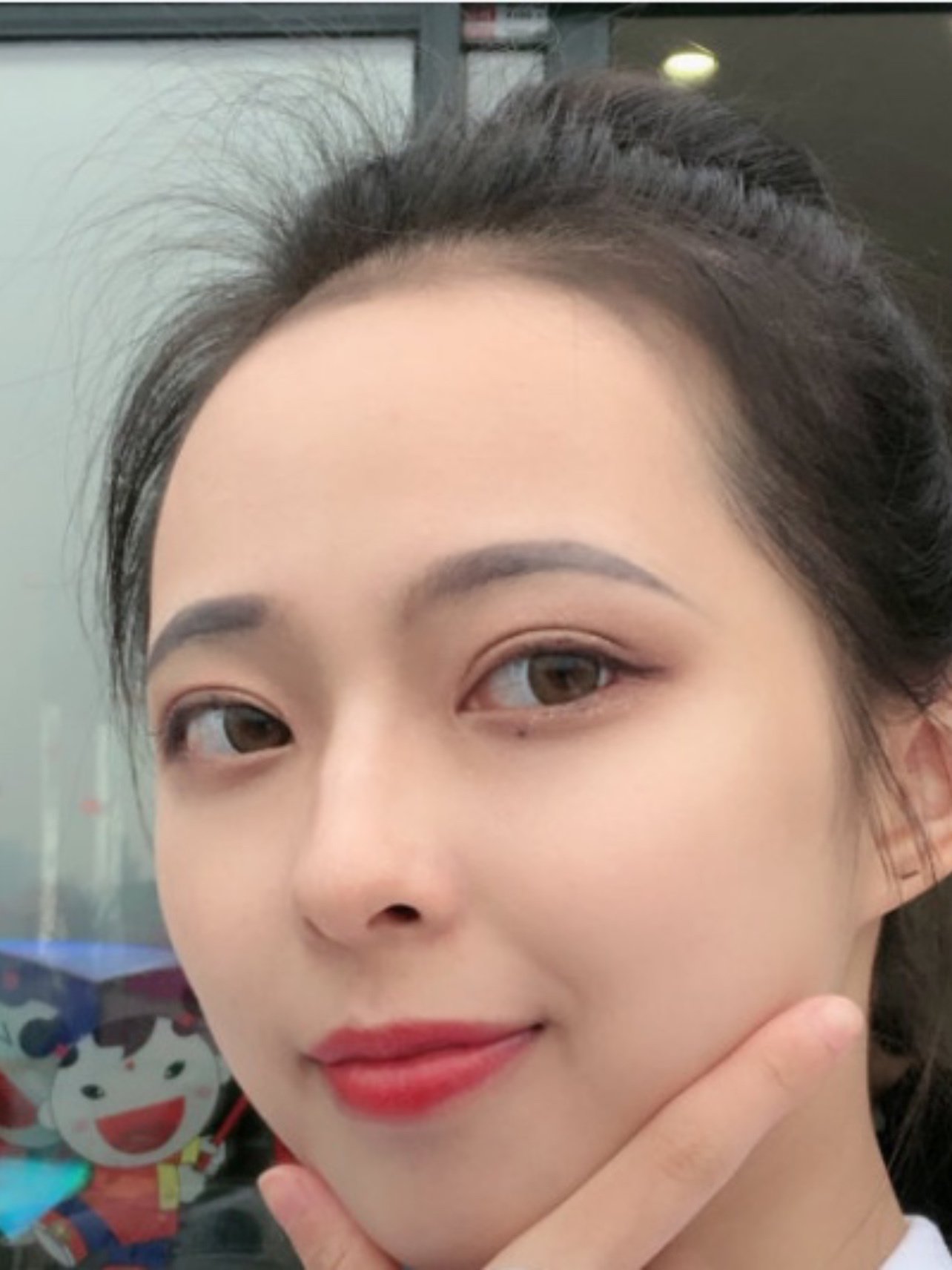 【切开双眼皮】切开双眼皮/开眼角 美杜莎双眼皮 精细缝合 术后自然