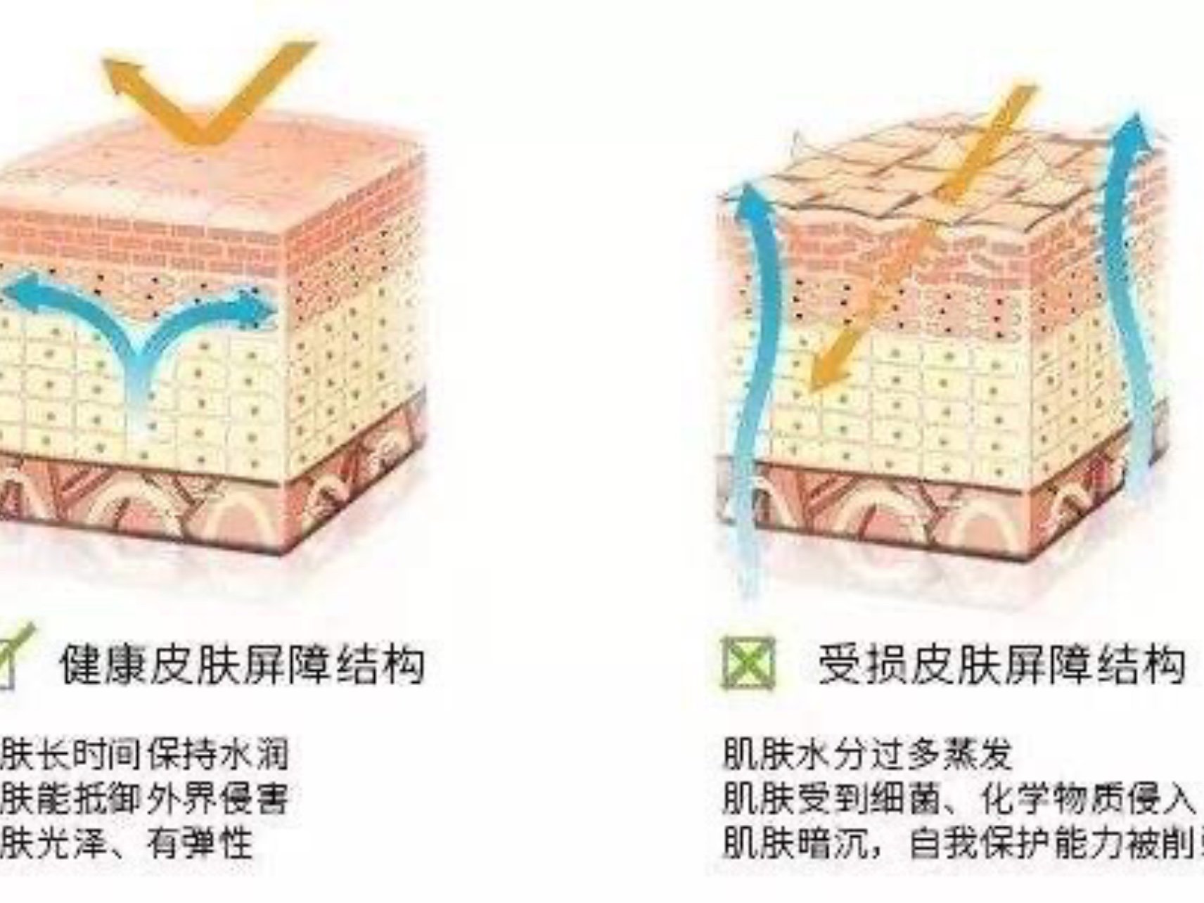 #皮肤屏障# 什么是表皮屏障？表皮细胞在分化的各阶_圈子-新氧美容整形