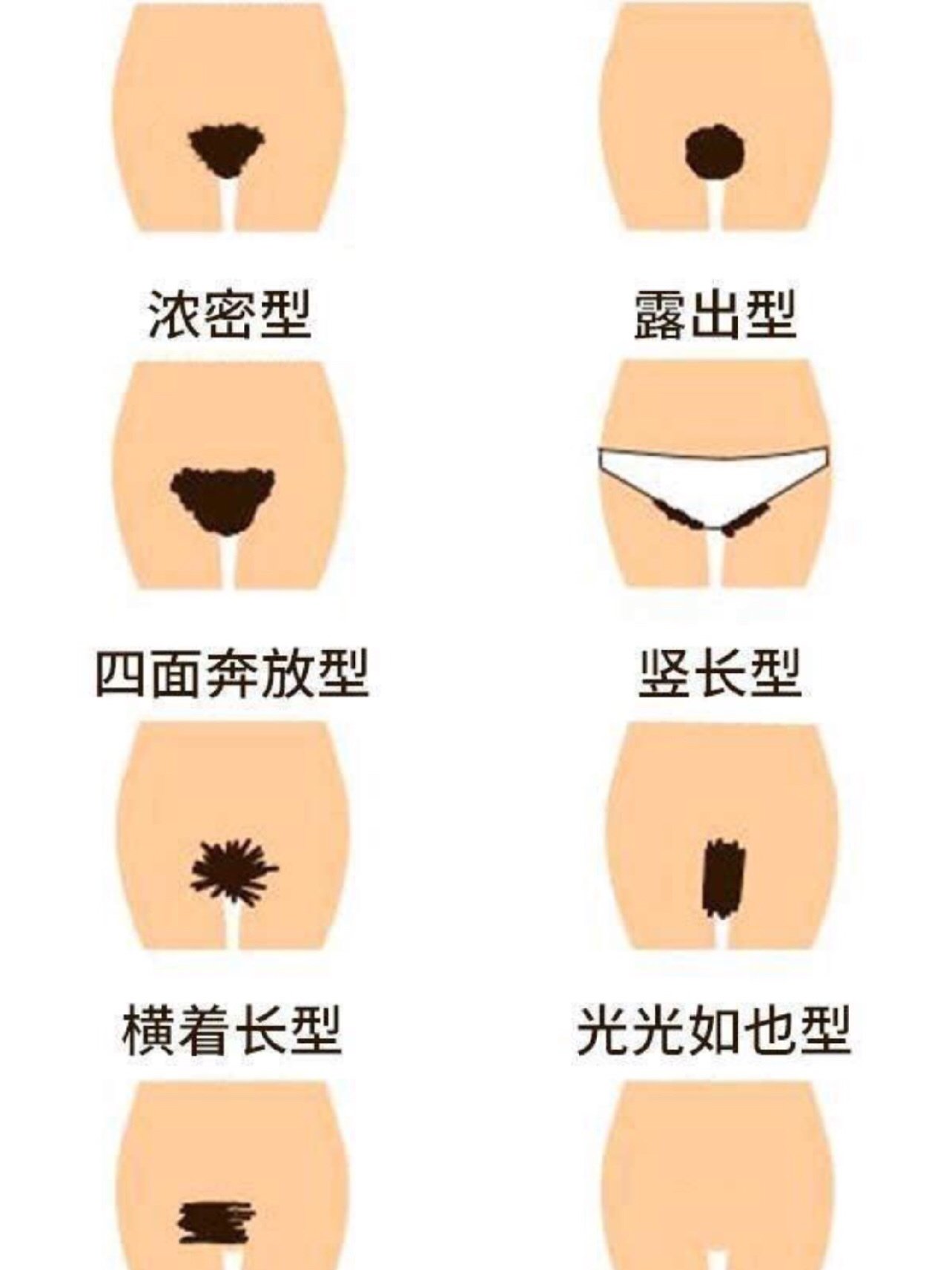 度假不尴尬 vio脱毛93真实全程919292性感的比基尼_圈子-新氧