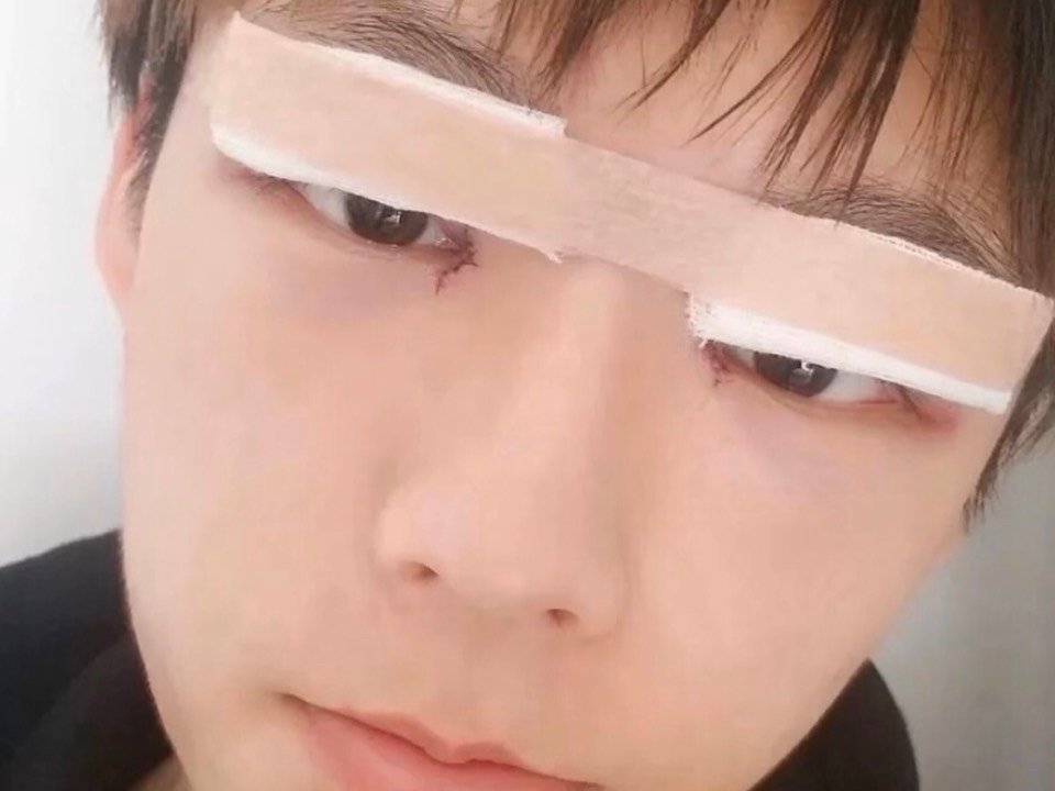 单变双有变帅吗男生双眼皮