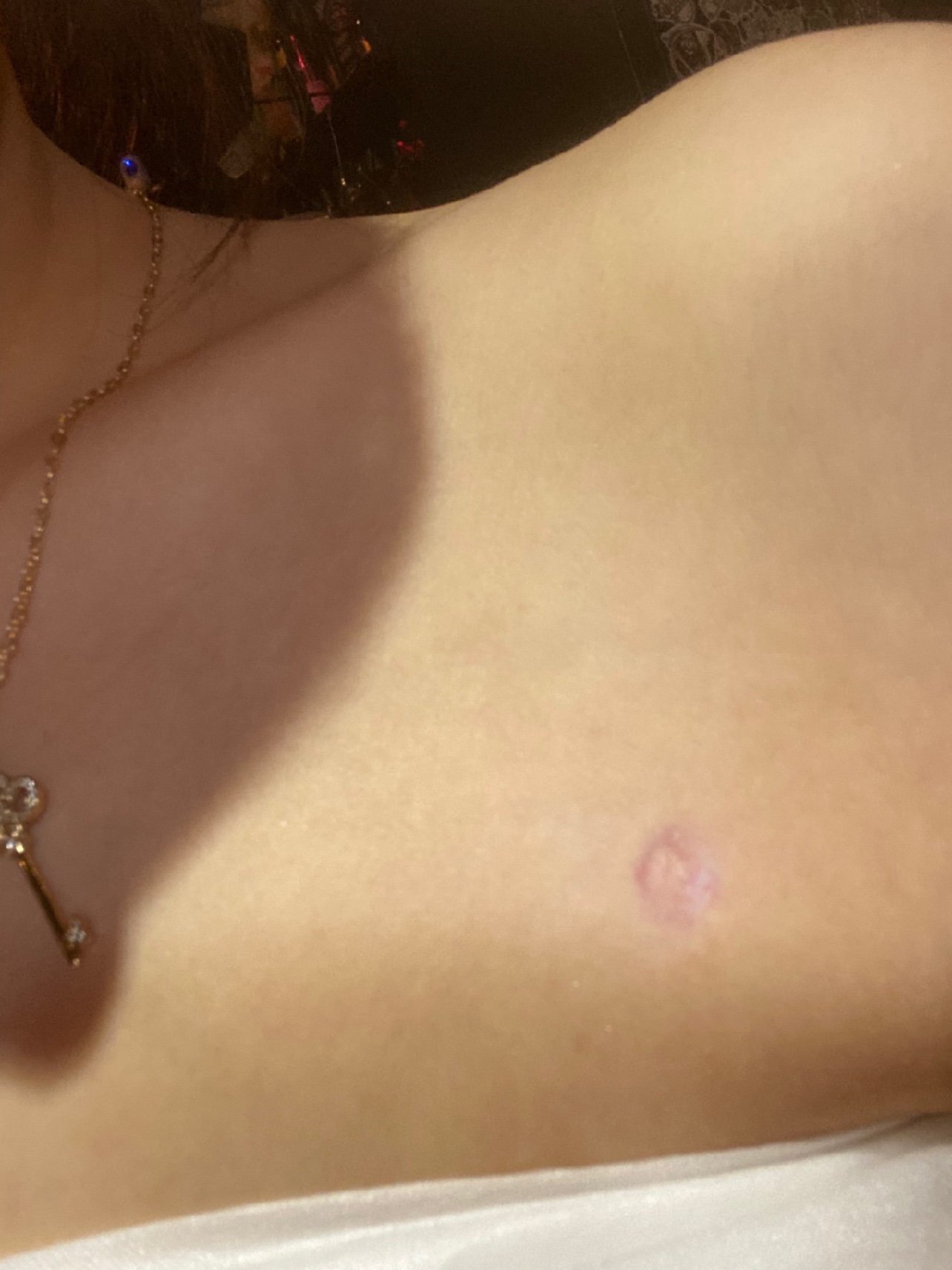 做了全身抽脂,隆胸,面部填充.