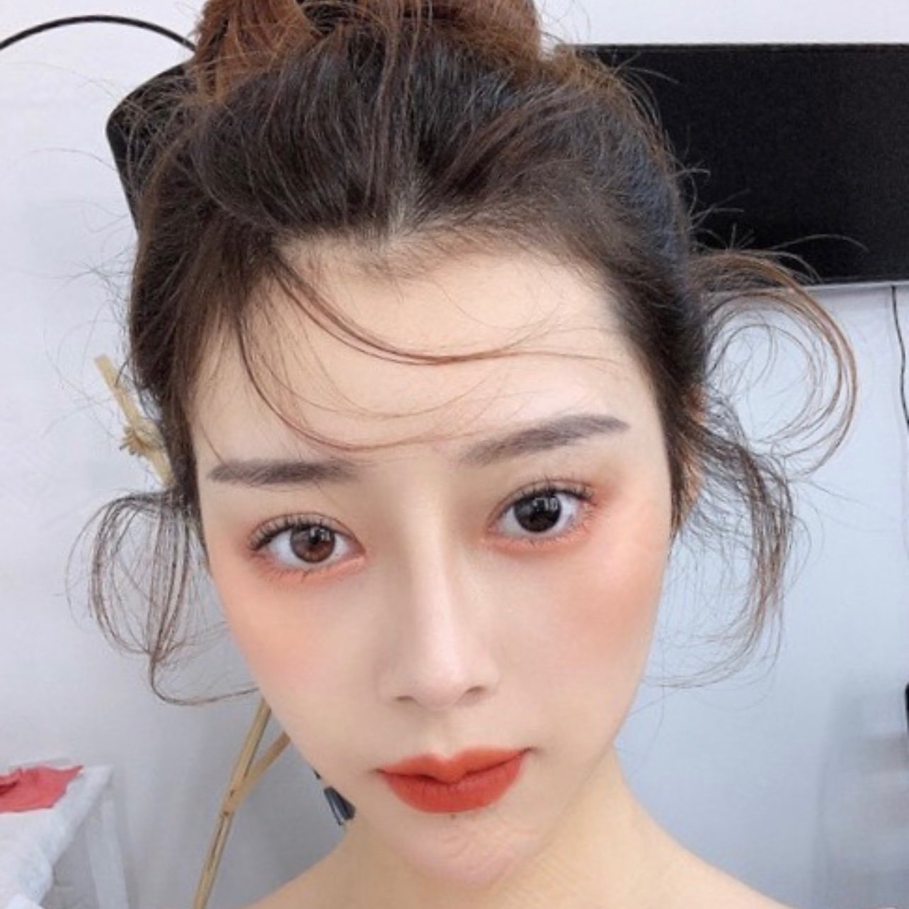 在凤凰岛做了平行扇形的重睑,还开了眼角,我术前眼皮_圈子-新氧美容