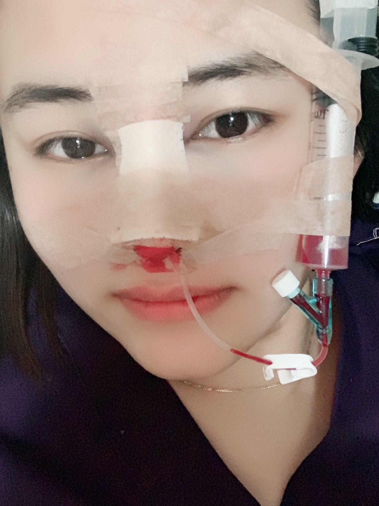 麻药过后胀痛耳朵也痛没有睡好