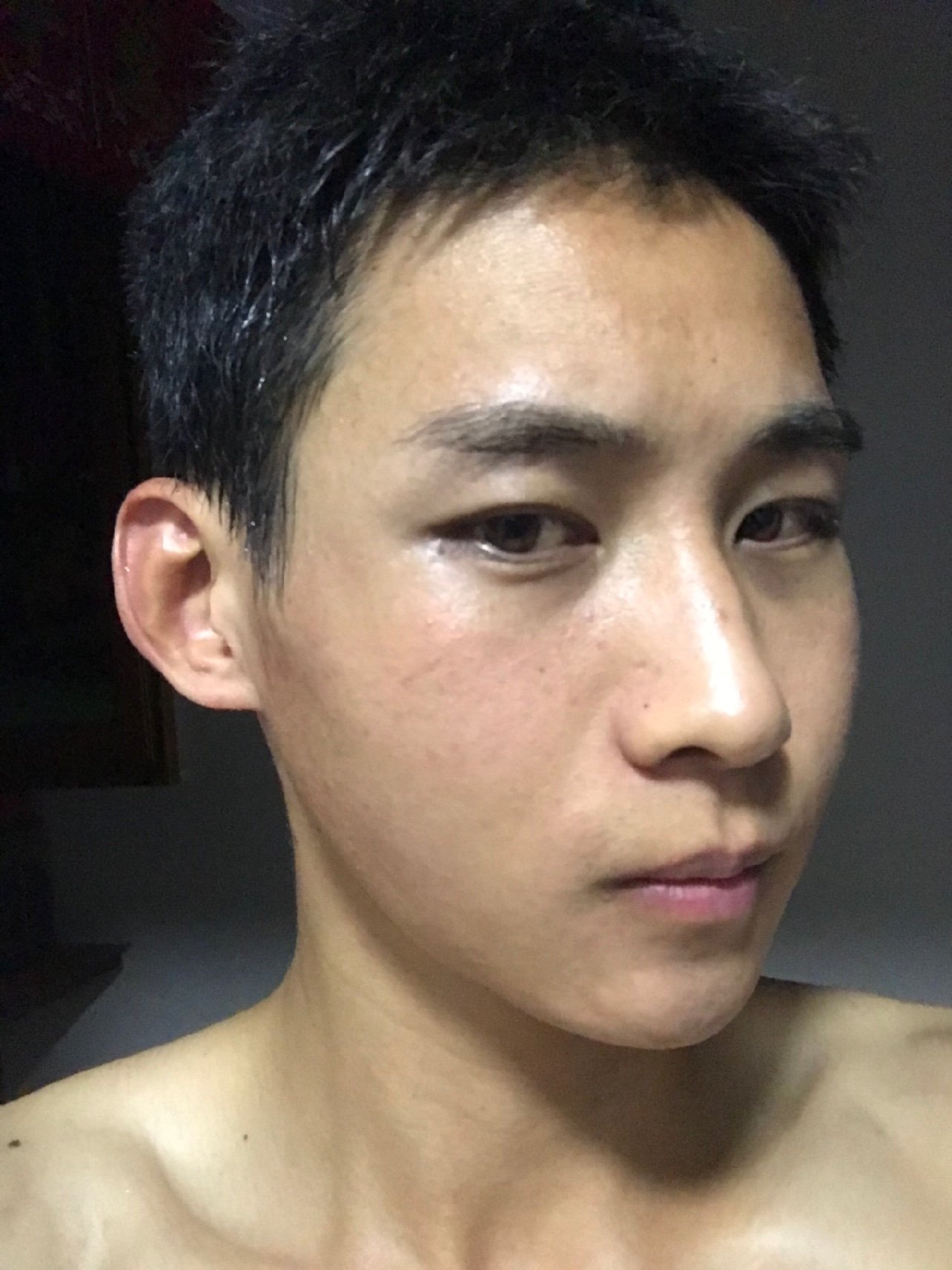 也不知道多少天了,脸型渐渐显现出来了,我的左边脸