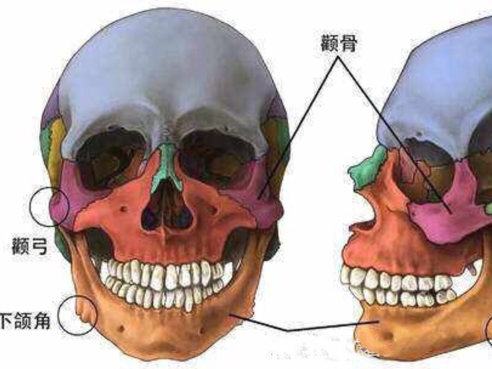 细数颧骨内推术后导致面部下垂原因有哪些?