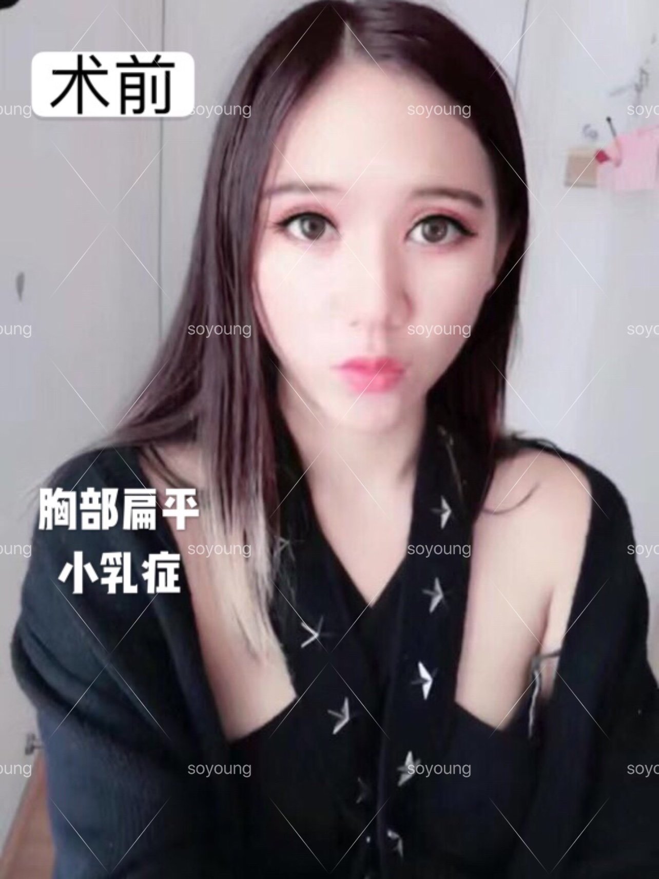 很多平胸妹子因為胸小胸平的問題從小就很自卑,有什麼_圈子-新氧美容