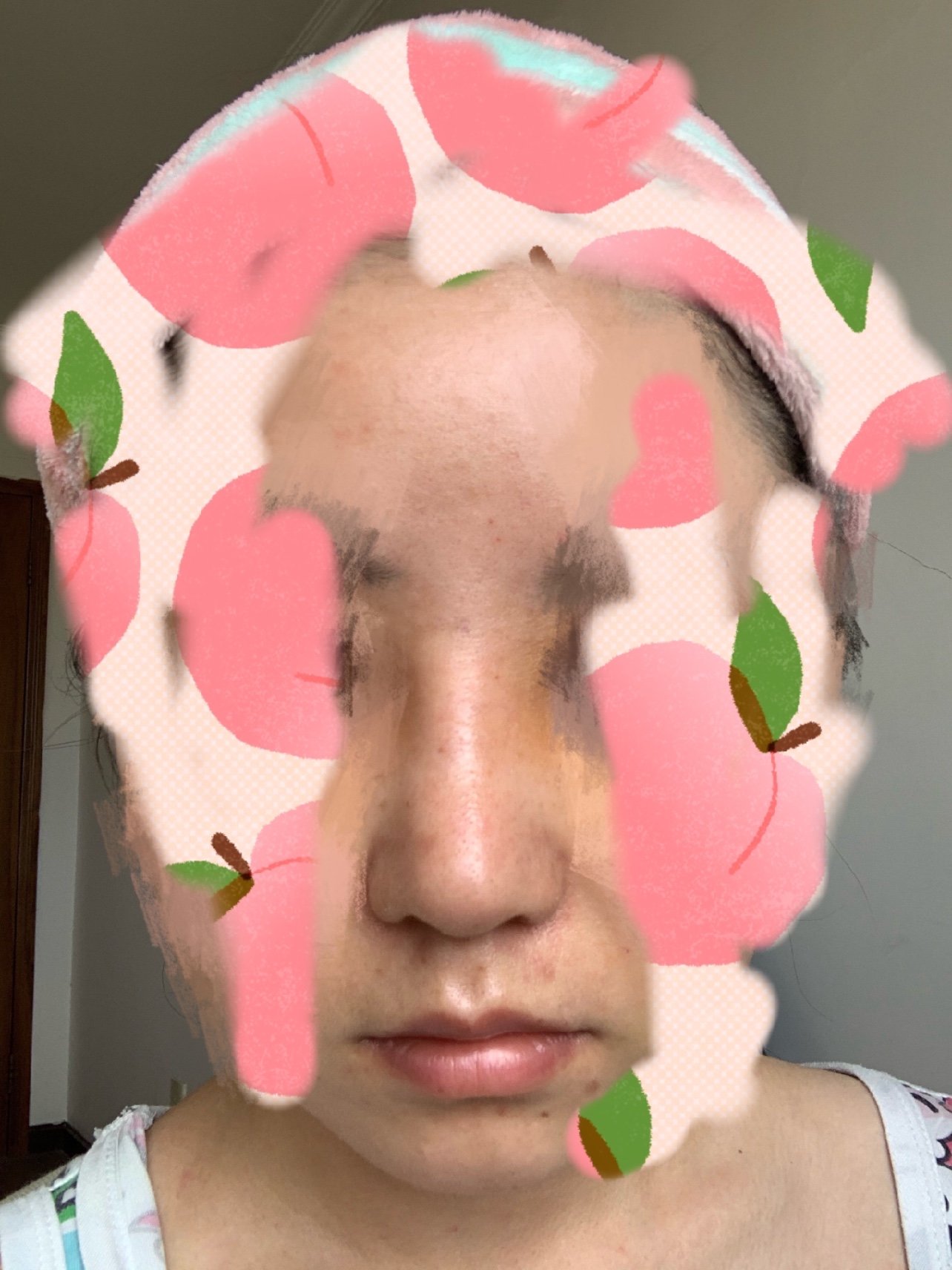 这个鼻子,是有点歪吧,鼻孔大小也不一样……宝宝们帮_圈子-新氧美容