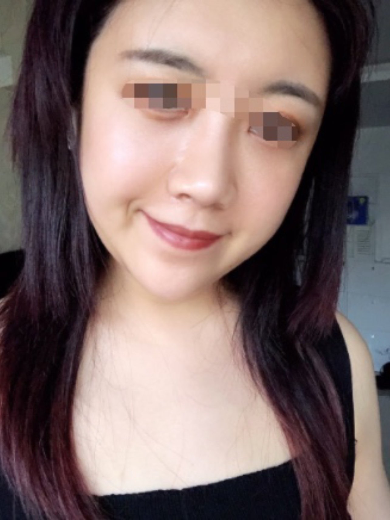 我自己本身不是很瘦,不知道为何面部会凹陷,女孩子真_圈子-新氧美容