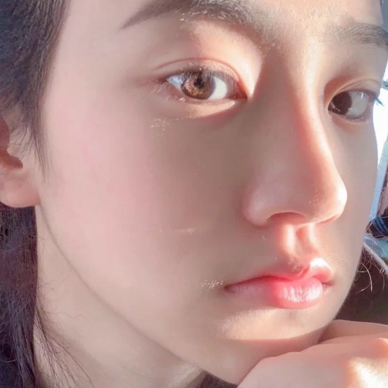 为什么做鼻子,鼻子太小了,鼻孔每次都被朋友嘲笑不能_圈子-新氧美容