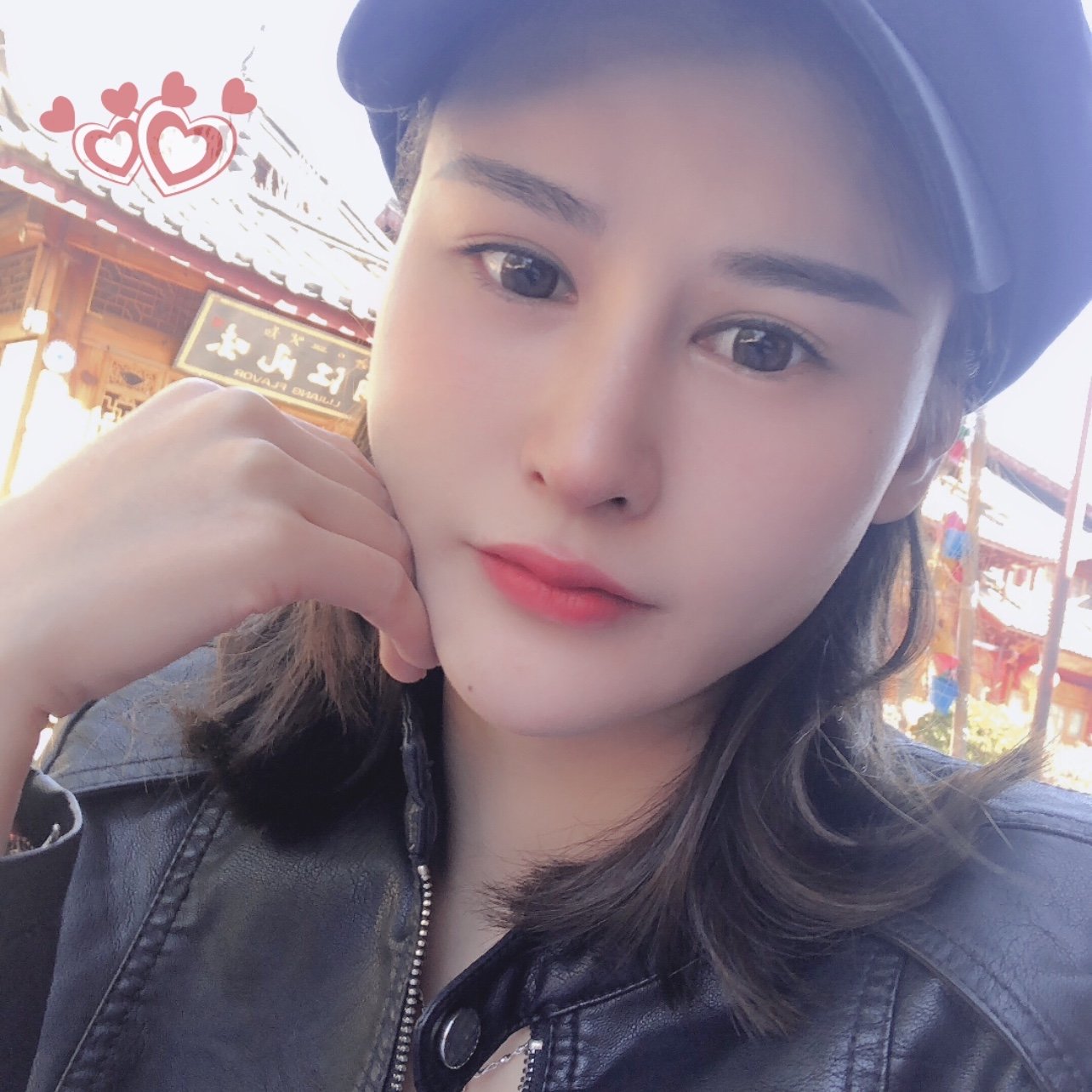 鼻孔外翻真的很丑,但是还是犹豫了很久才决定去做鼻综_圈子-新氧美容