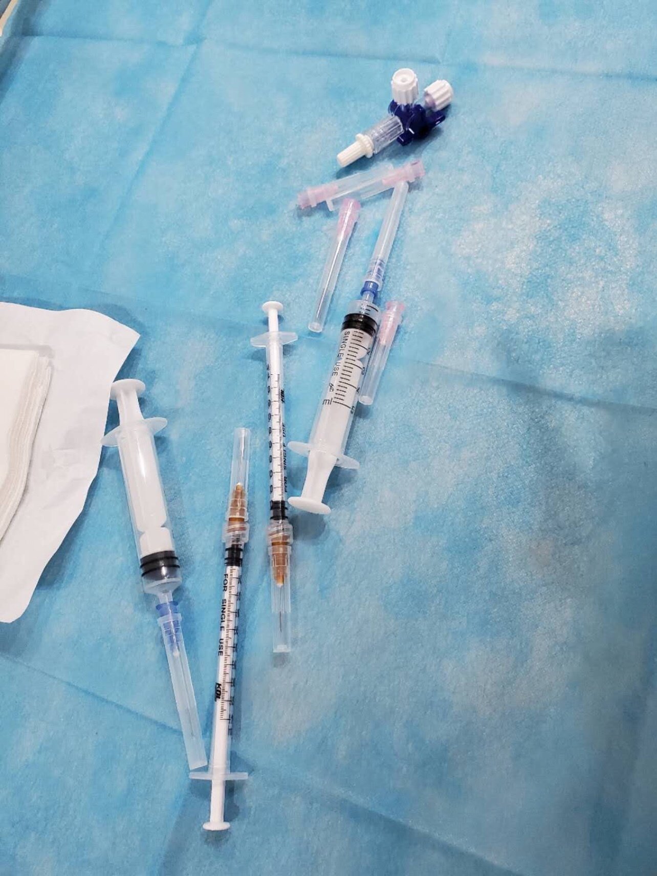 工作日来广州雍禾植发体验我的德玛莉小棕瓶生发液——_圈子-新氧美容