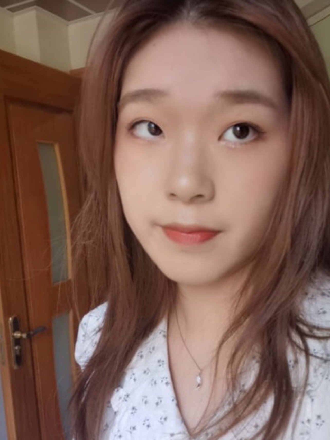 看自己的圆鼻头烦死啦!思前想后还是来医院做修复了!