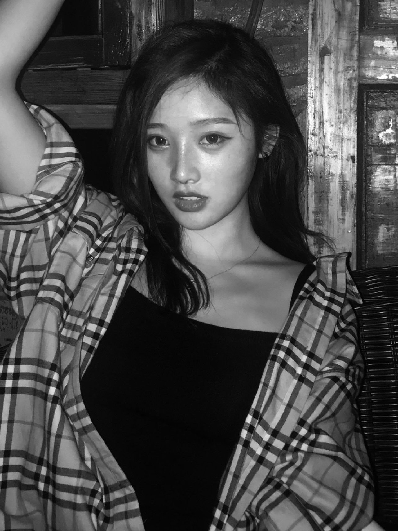 手术后第8天 【星妍医美 鼻部多项】术后第七天,我的_圈子-新氧美容