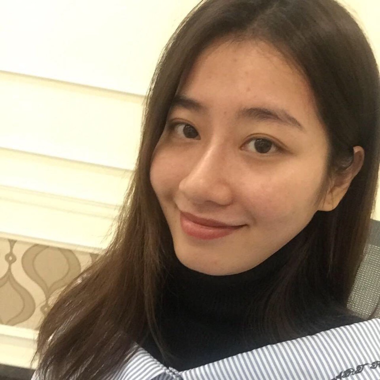 我对医美是个外行,只是单纯的想把自己的脸变饱满年轻,咨询医生很有