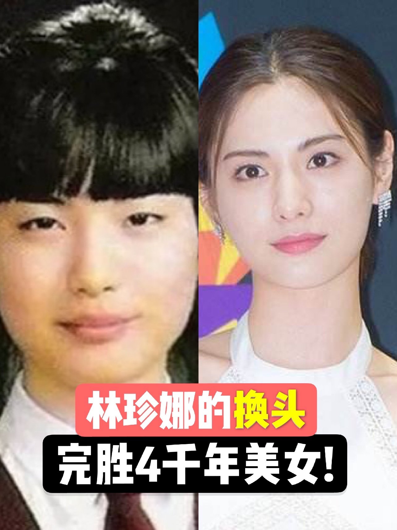 林珍娜nana,连_圈子-新氧美容整形