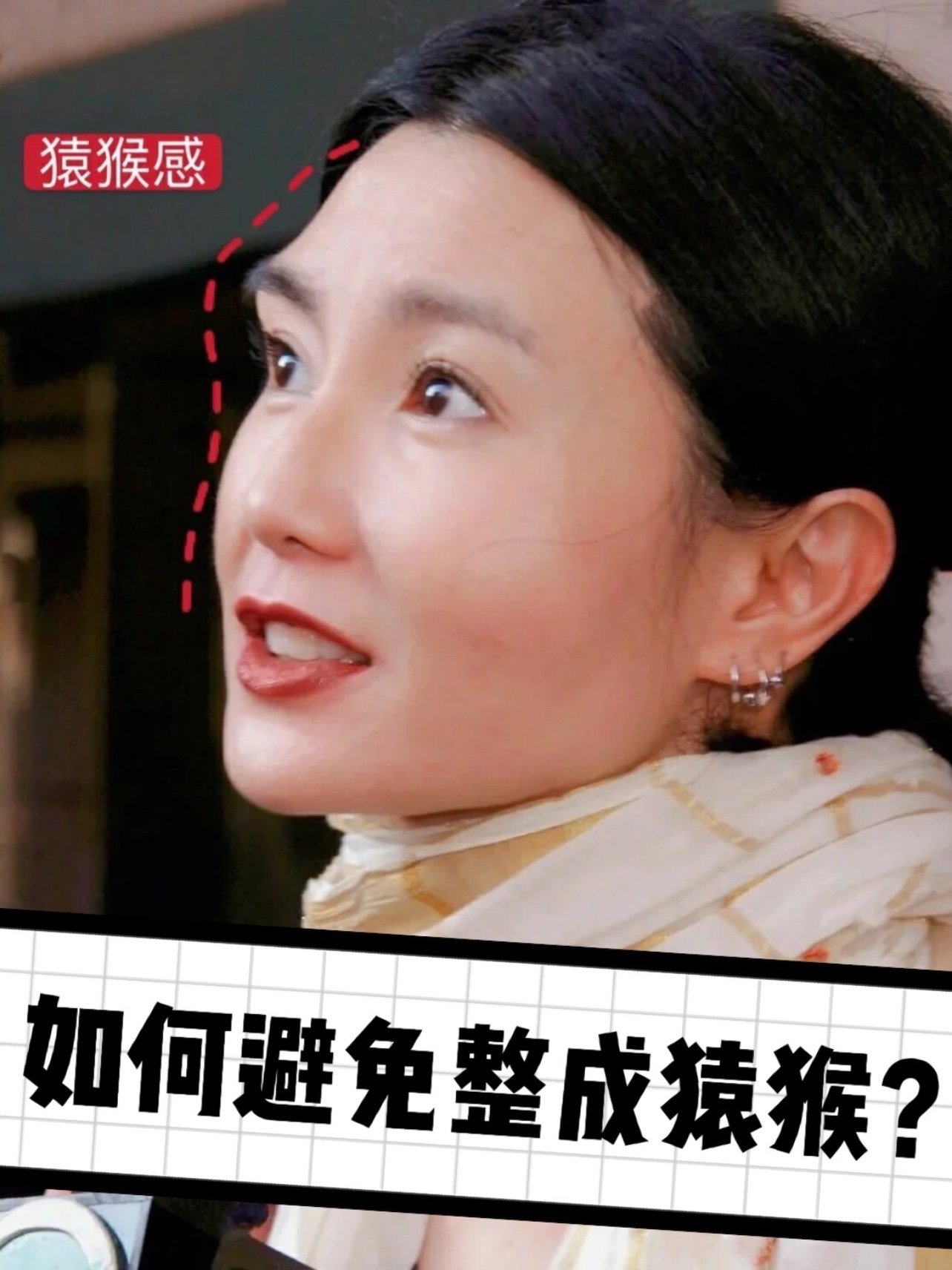 出现猿猴感的原因是眉弓太高