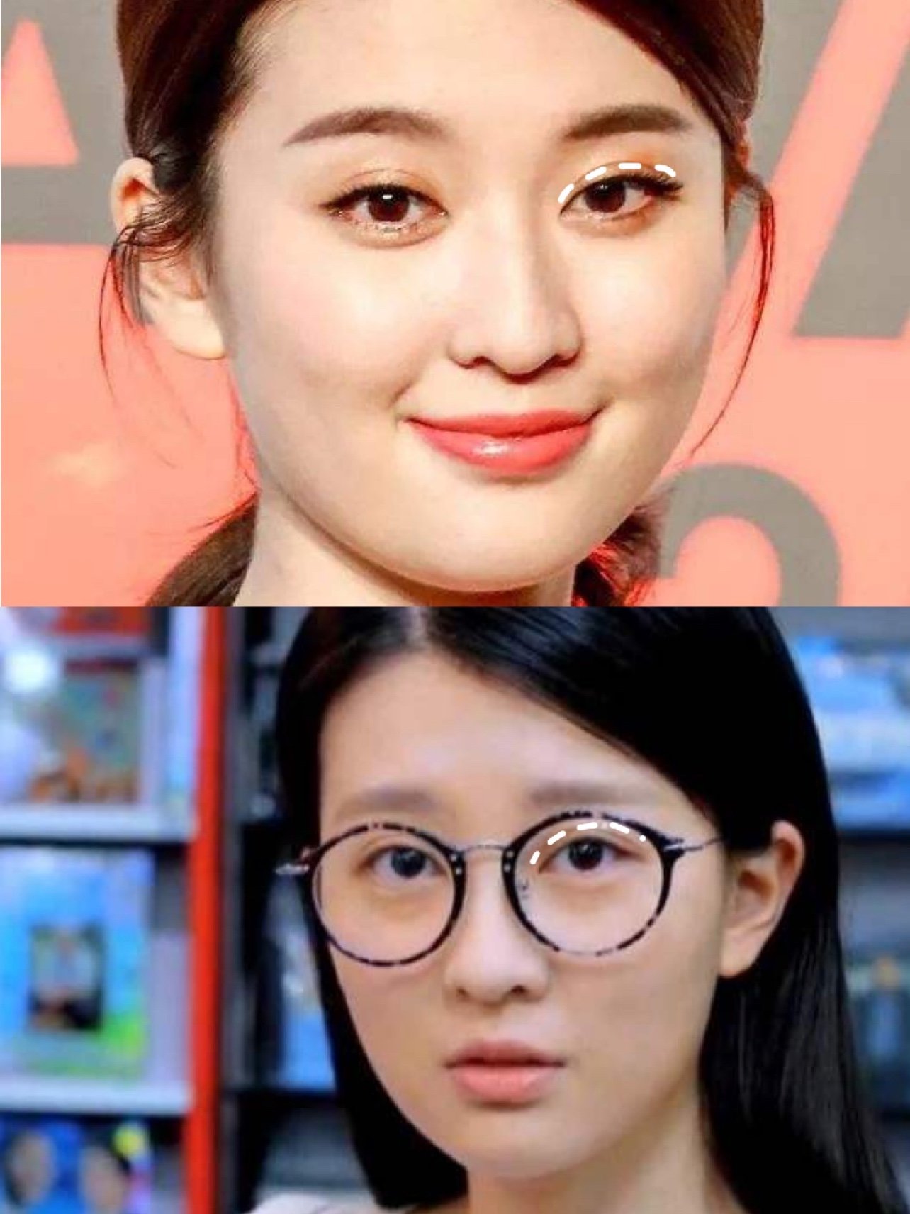 73乔欣的眼睛做了什么?