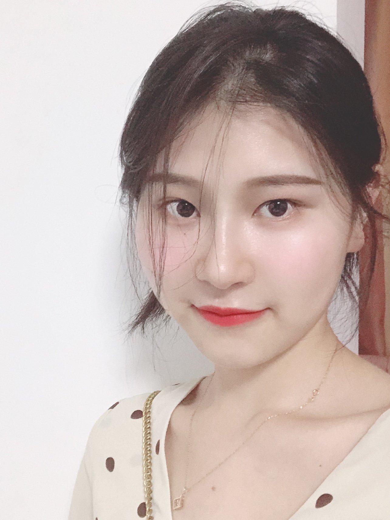 一个鼻子圆圆的人,做一个欧式小翘鼻会怎么样_圈子-新氧美容整形