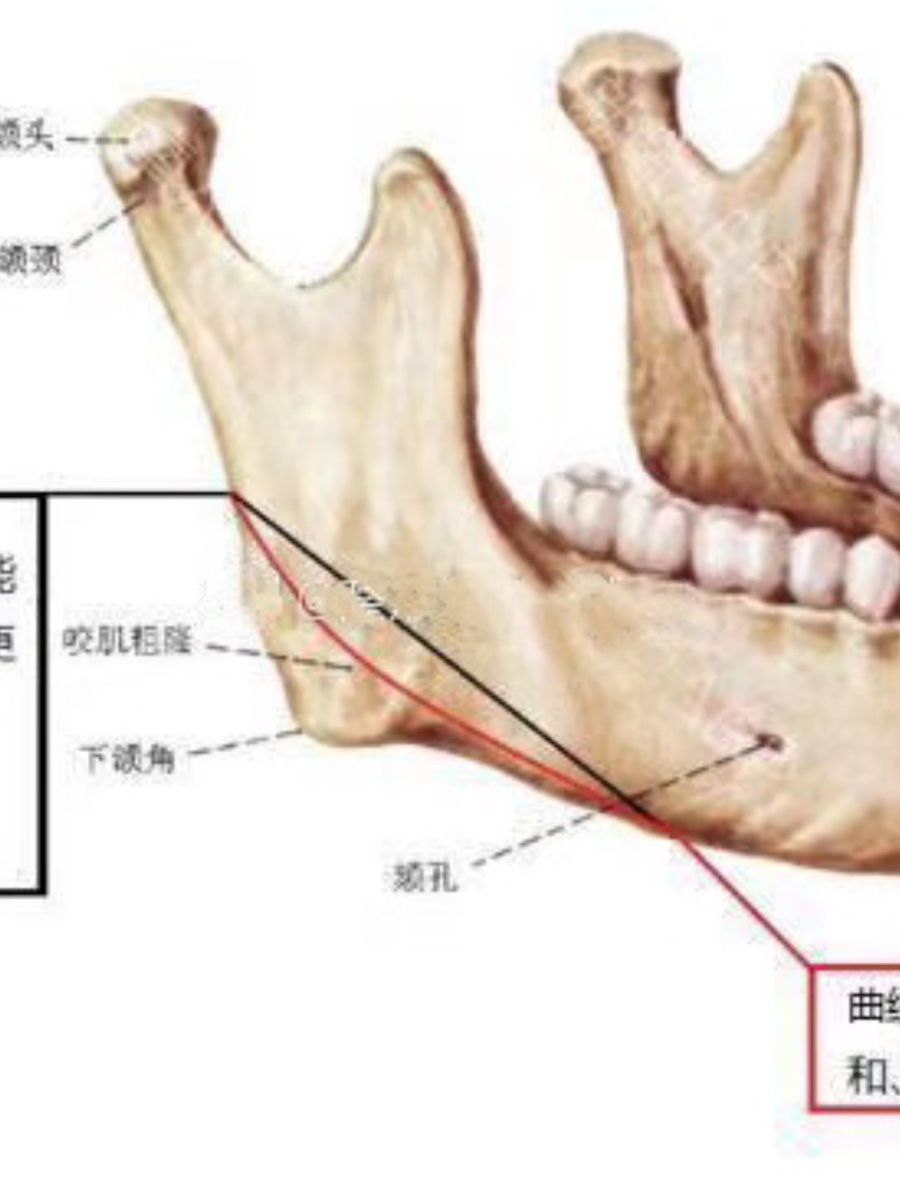 截骨,削骨,切骨,磨骨傻傻分不清楚?