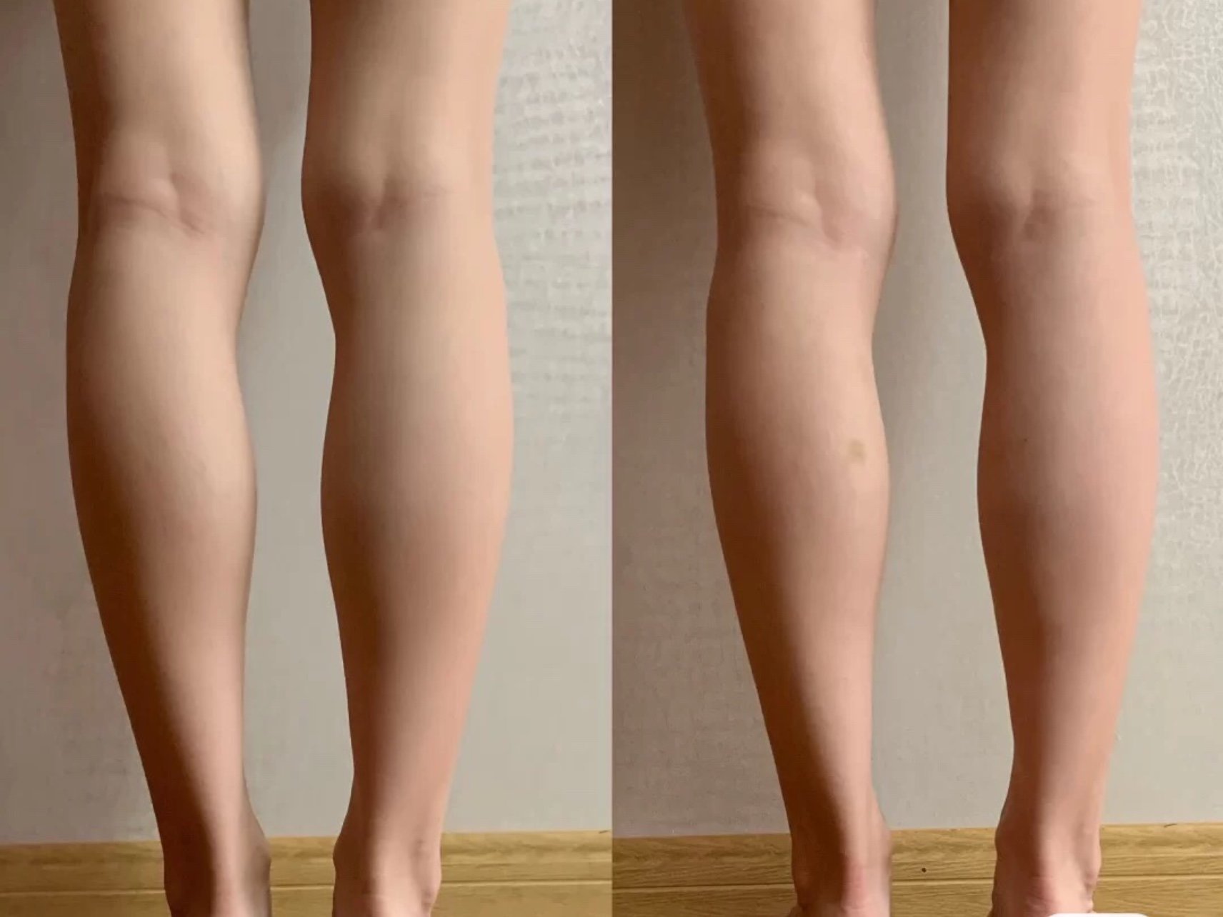 女生瘦腿前后对比照片图片