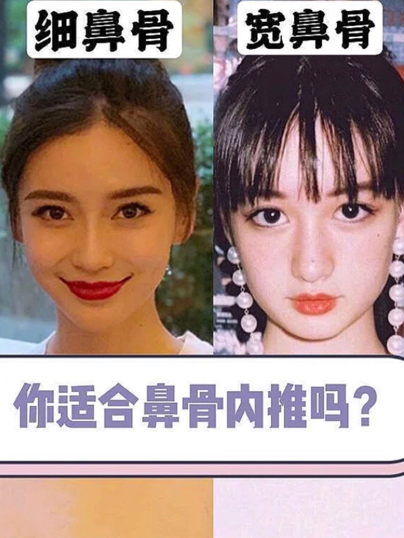 你适合鼻骨内推吗71