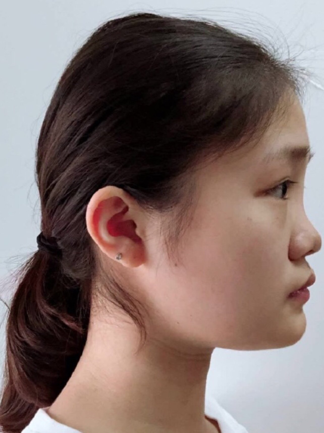 我不喜欢鼻梁特别高的那种效果,鼻子的高度,形状和大_圈子-新氧美容