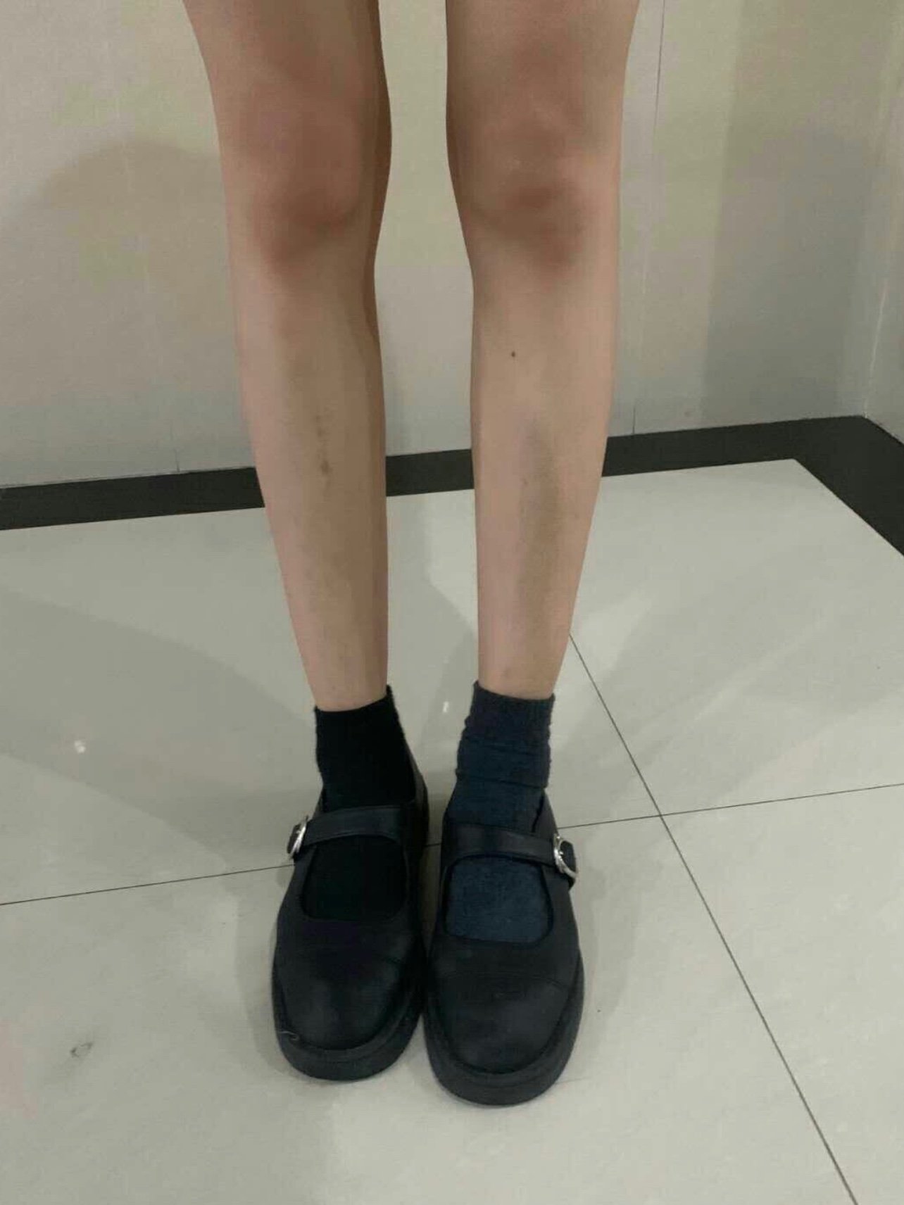 腿上的肌肉比较发达,然后刚好之前朋友也打过,感觉效_圈子-新氧美容