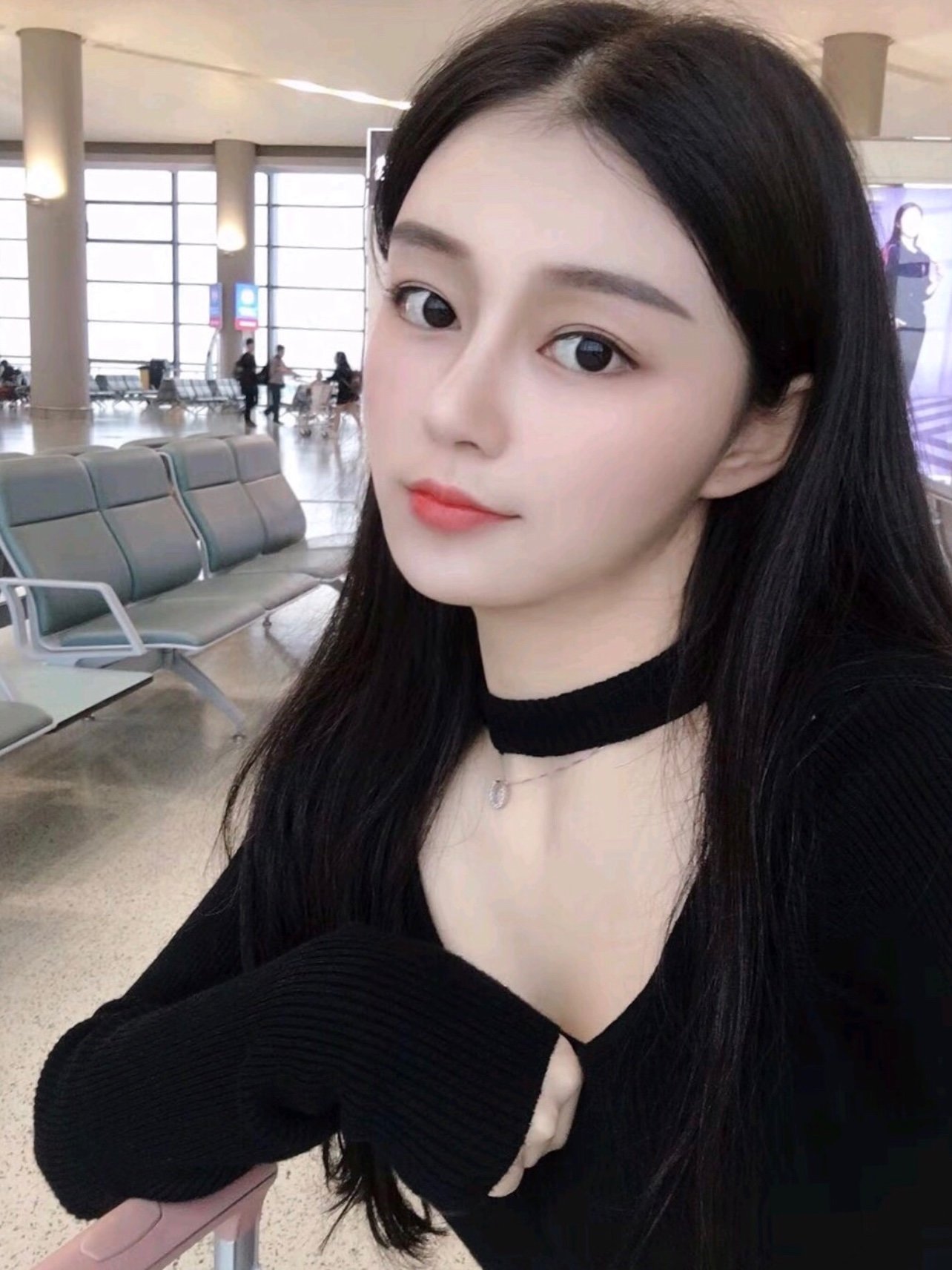 鼻型自然又好看,非常感谢张主任给我做的鼻子,是个负_圈子-新氧美容