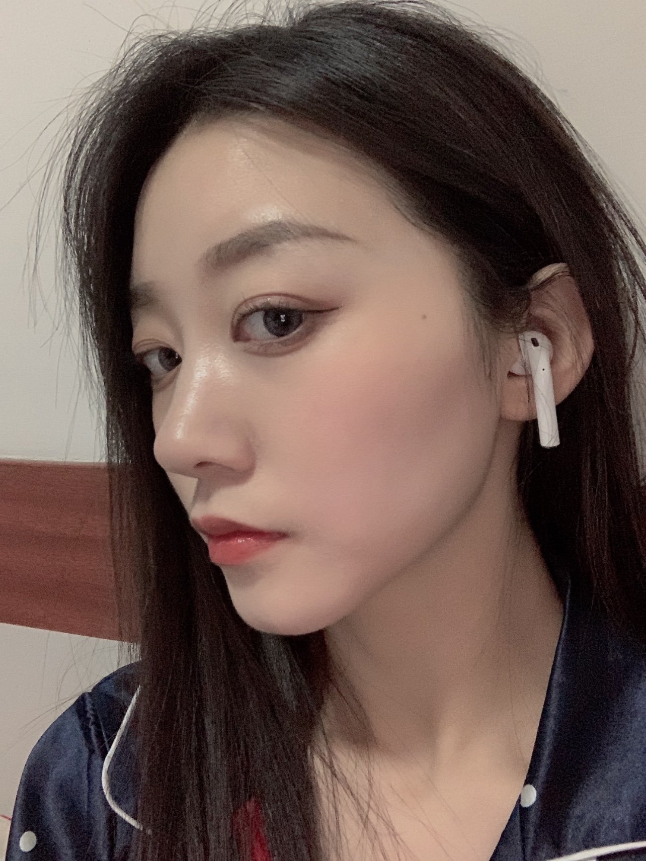 妈生款美鼻来了,爱了爱了,大家看我之前术前照没,丑_圈子-新氧美容