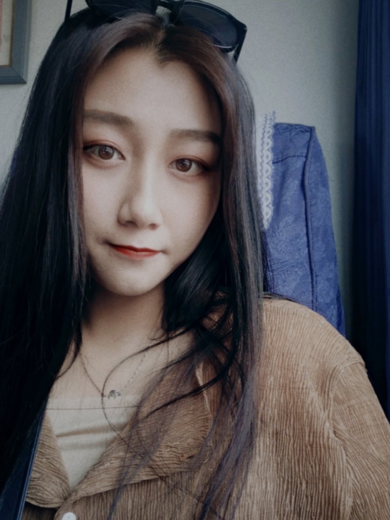 恢复得很好,很自然,平时就算不化妆也很好看自信满满_圈子-新氧美容