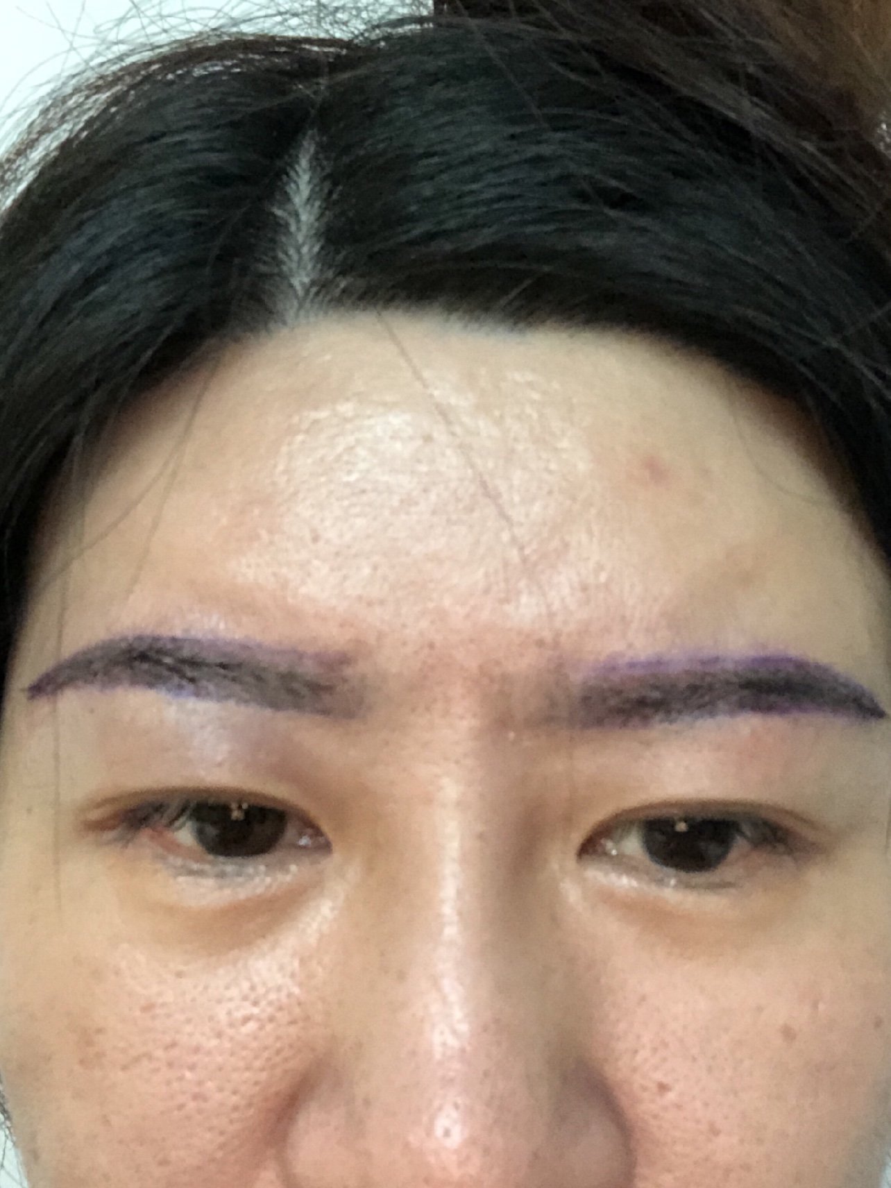 【种植眉毛】【特惠一口价】私信下单可返30% 微针私人定制眉毛 改善