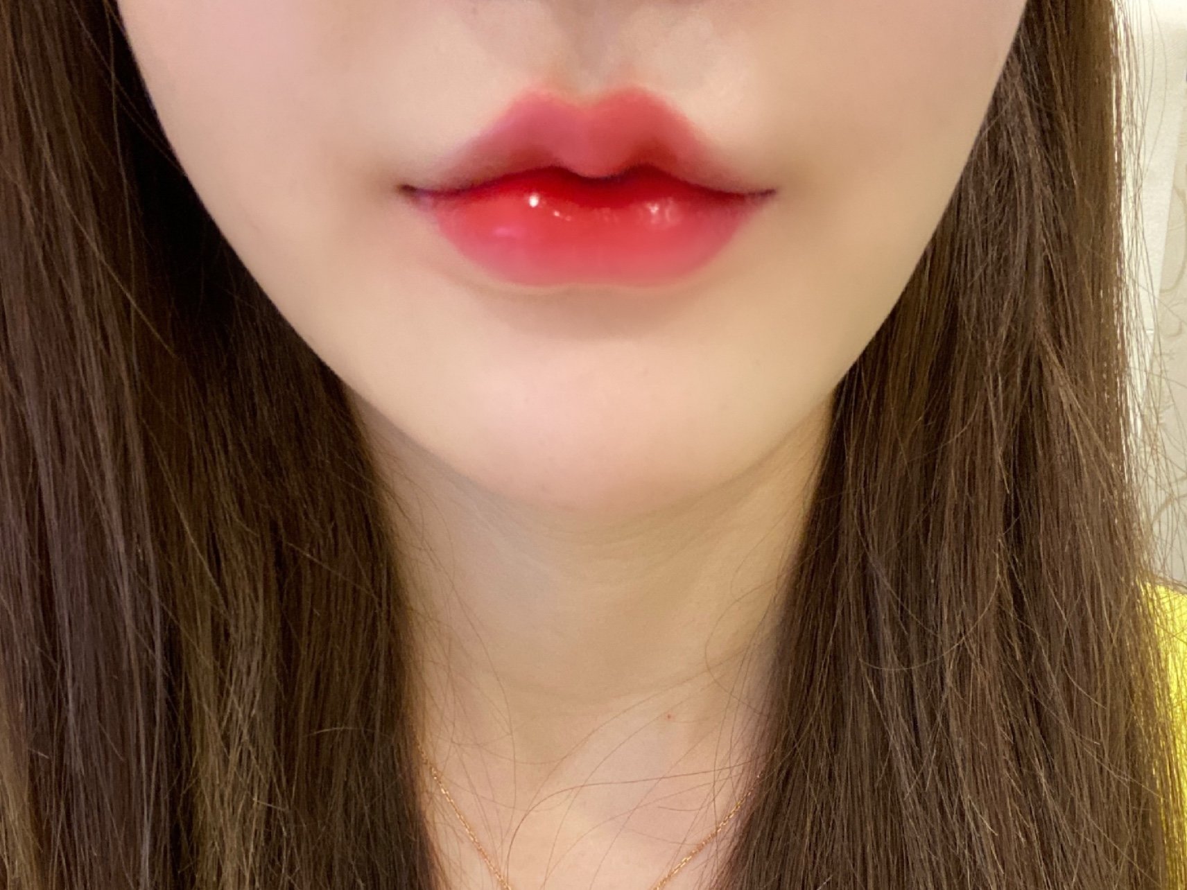 做了个果冻唇太喜欢了,现在看嘴巴越来越好看,不后悔_圈子-新氧美容