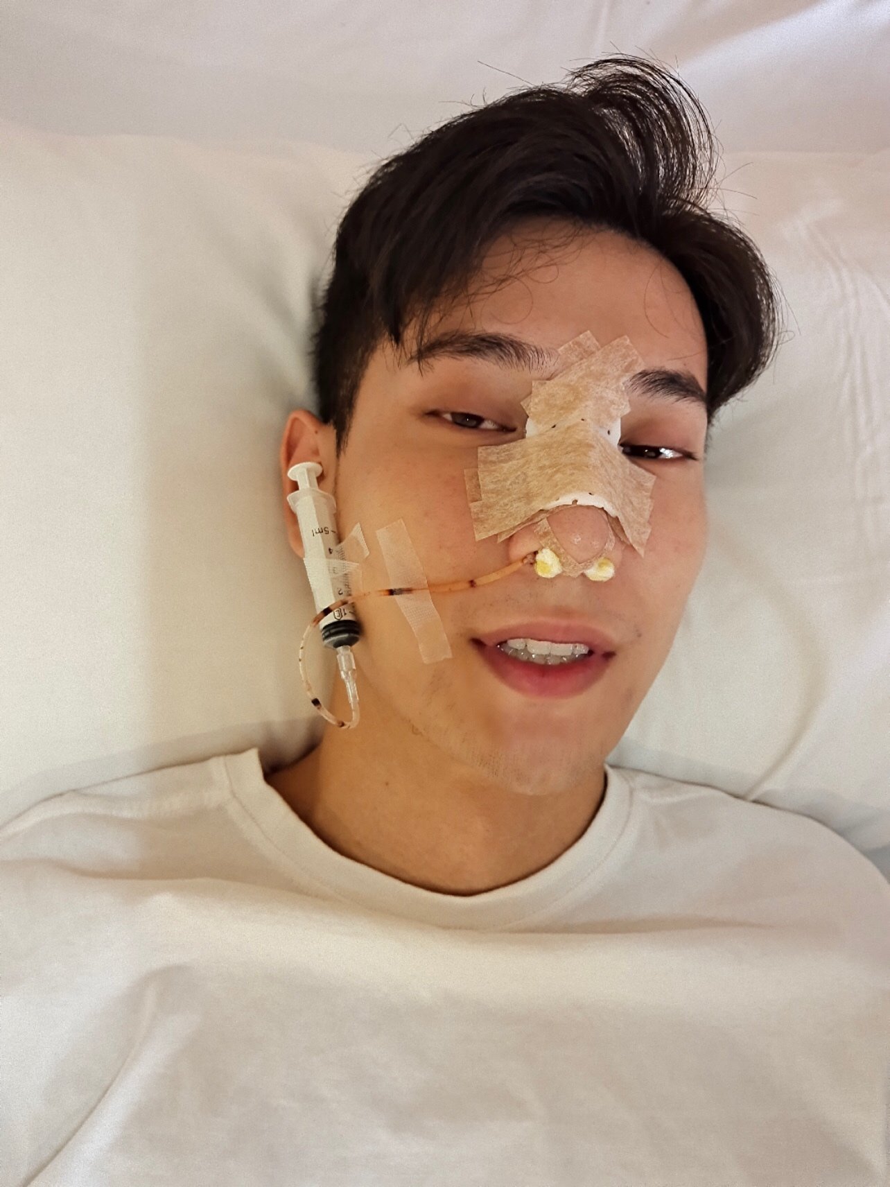 鼻子是包着的,肋骨那里也是包扎了的,除了这两个地方有点痛外,其他