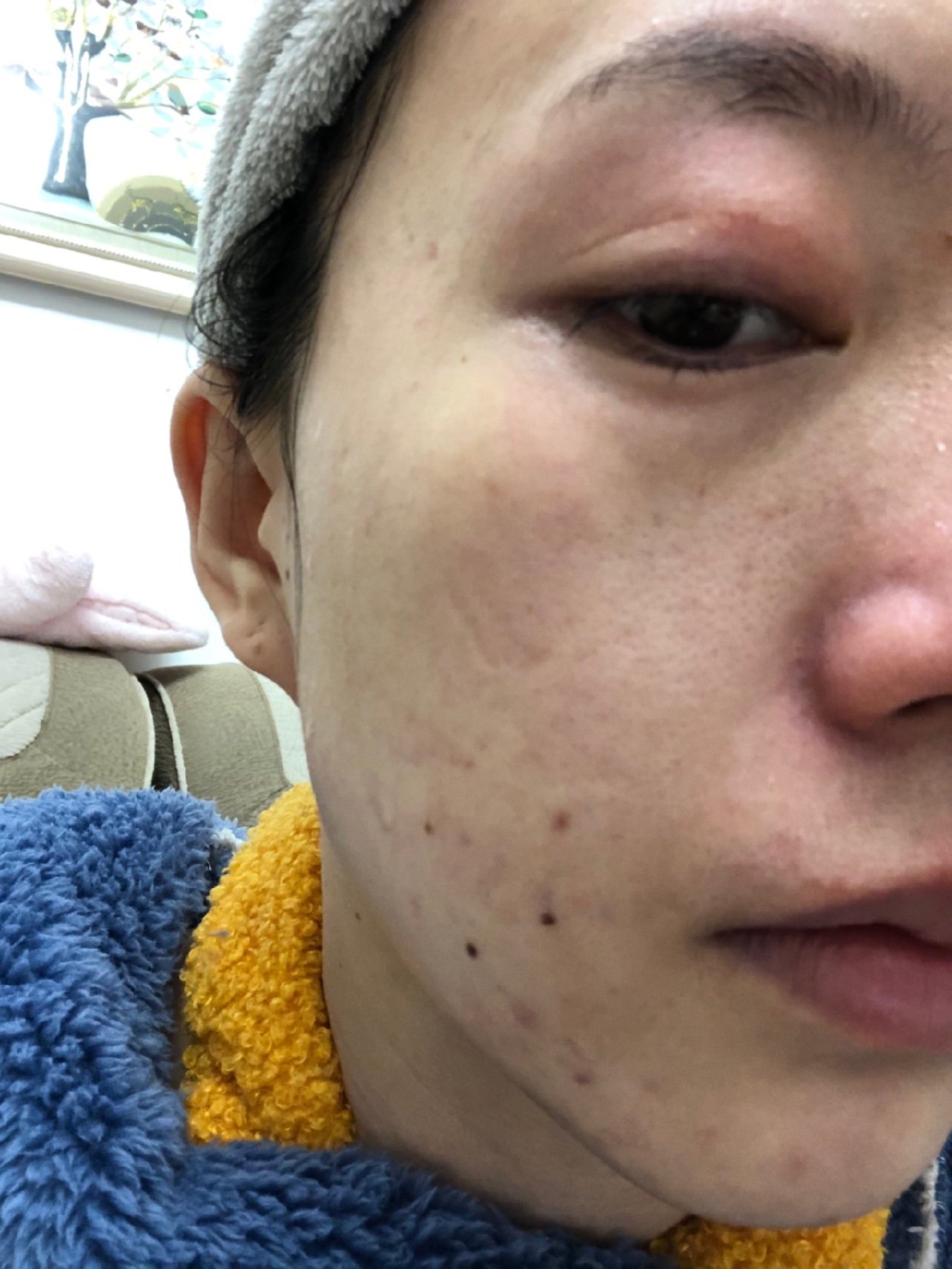 新氧体验官 先来说说我的皮肤状况,本人是超级油皮,毛孔巨大的那种