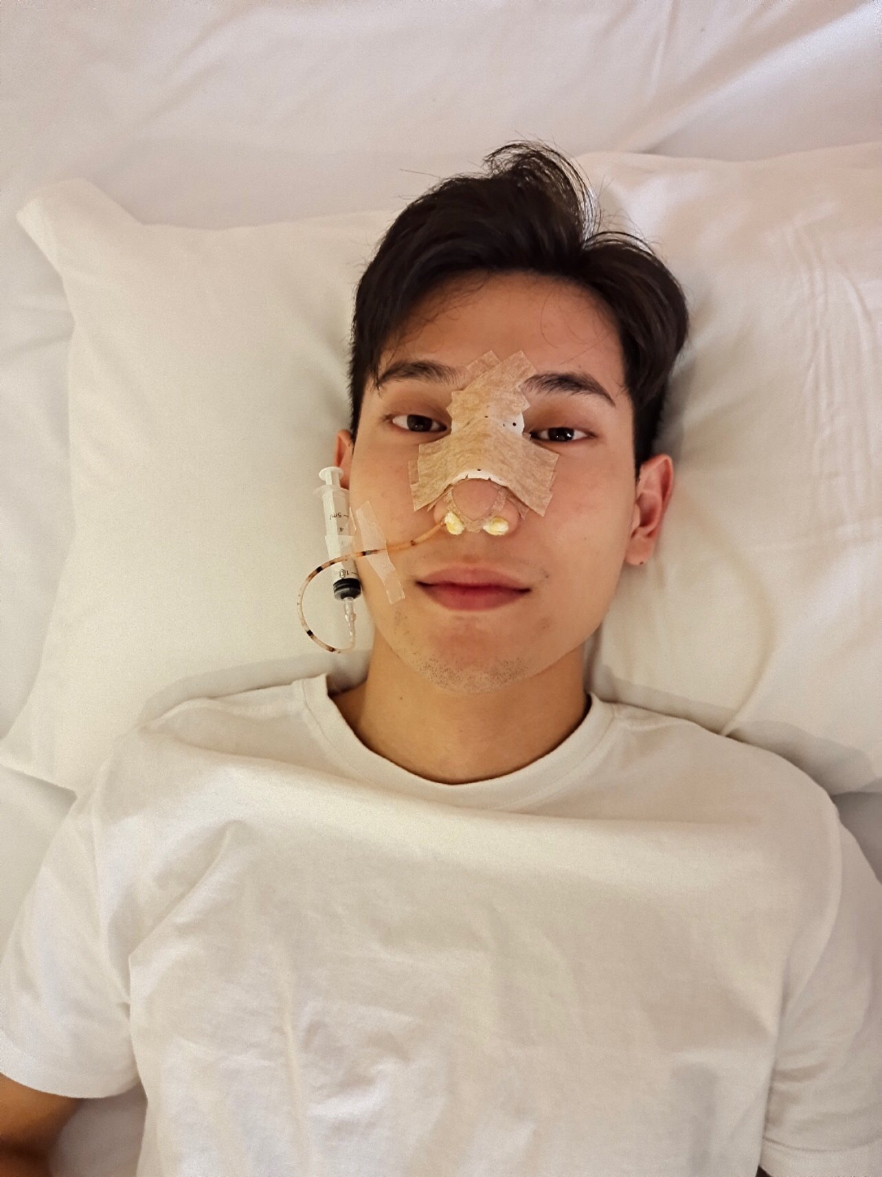 鼻子是包着的,肋骨那里也是包扎了的,除了这两个地方有点痛外,其他