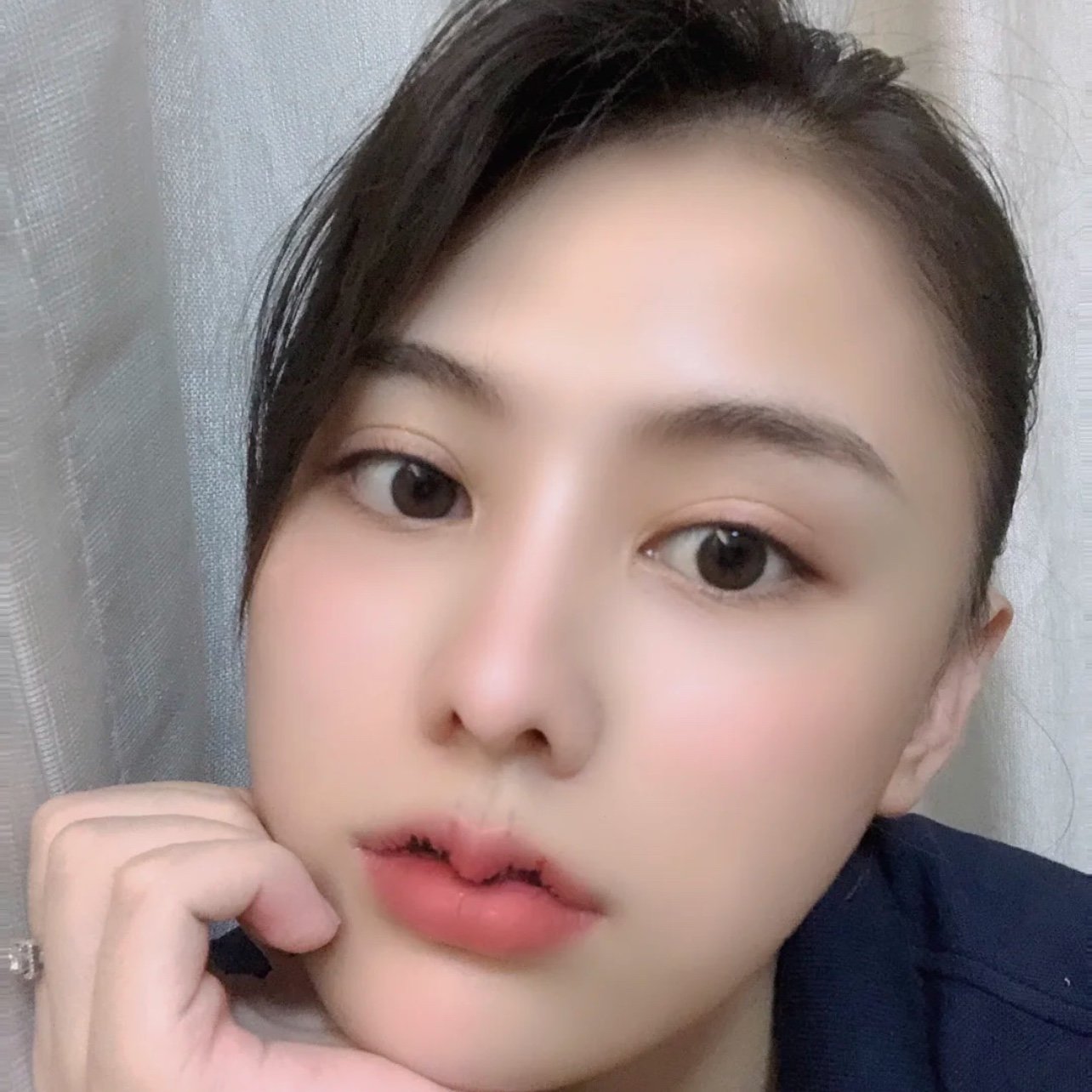 我真的喜欢了喜欢了这个唇早知道早做了,手术全程就半_圈子-新氧美容