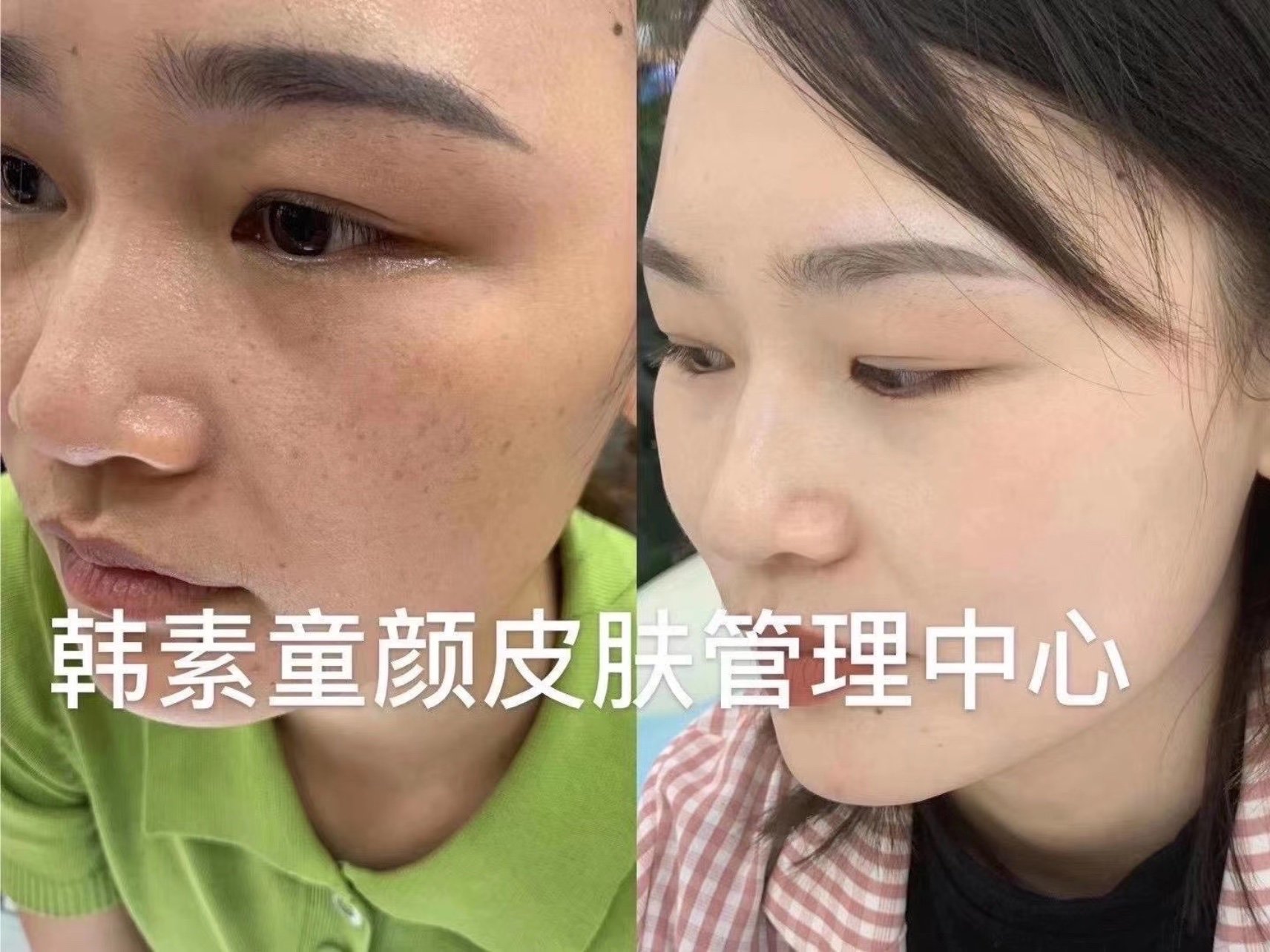 韩素童颜78每天都有新的惊喜]效果品质就在这,说再_圈子-新氧美容