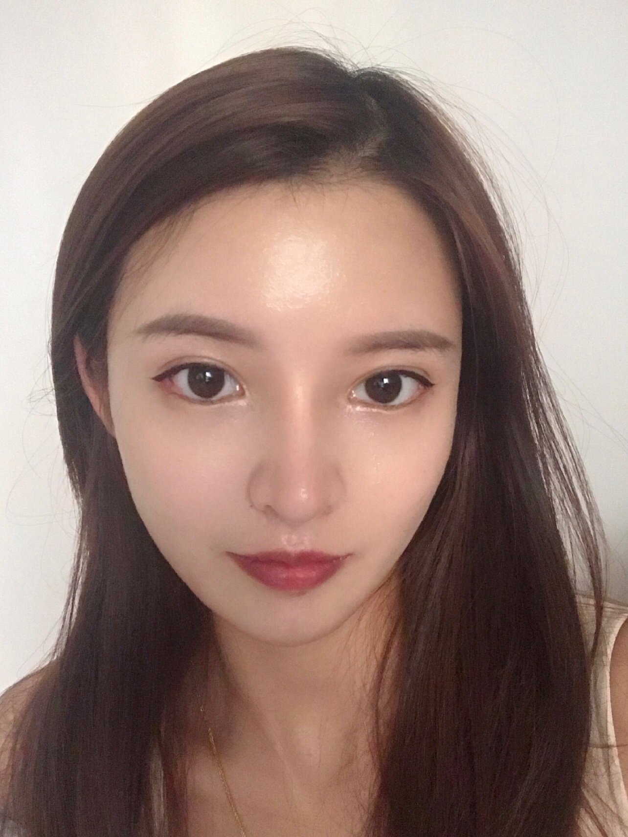 在妍熙做的是眼睑下至和外眼角,我自己原本就有双眼皮_圈子-新氧美容