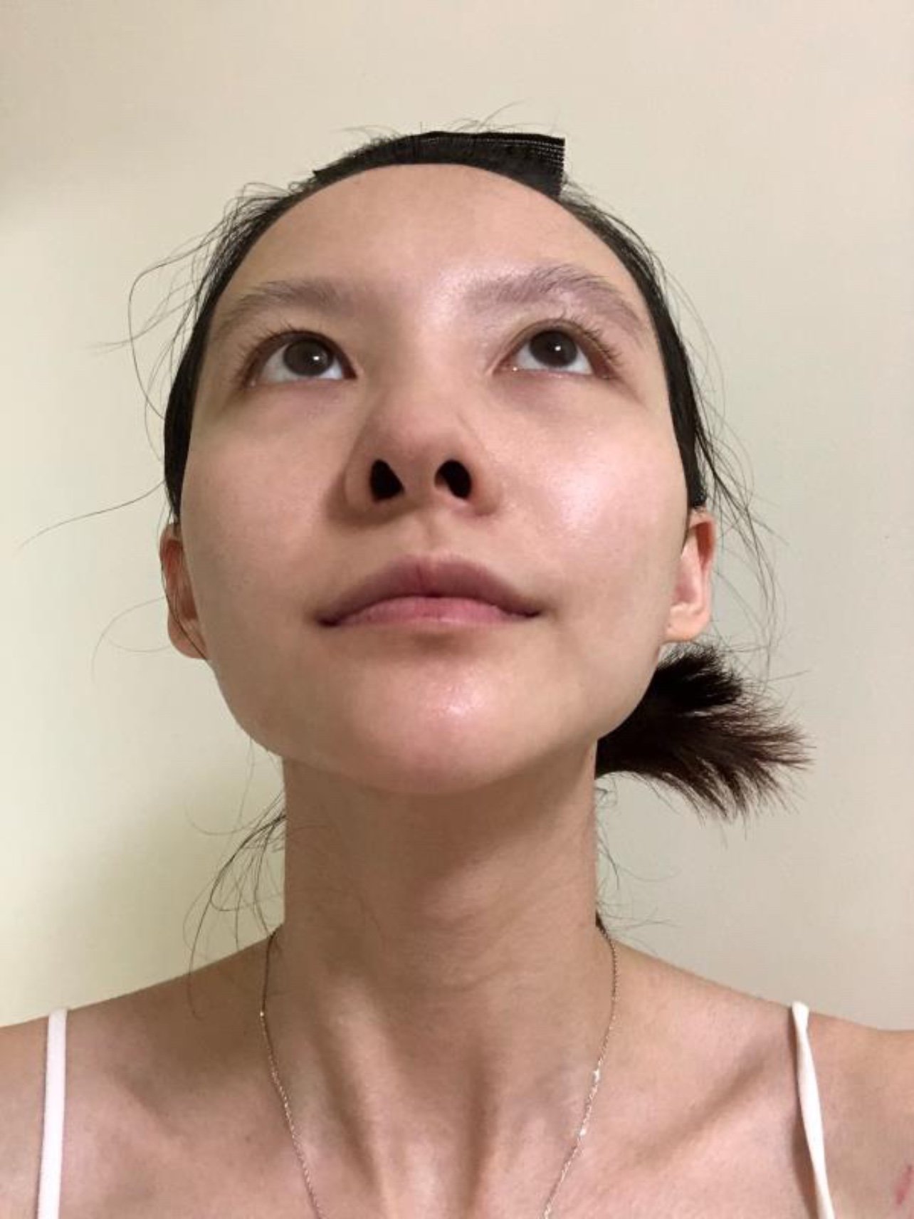 27岁以后,皮肤明显下垂,从事服务行业的我深知形象有多重要,虽然月薪