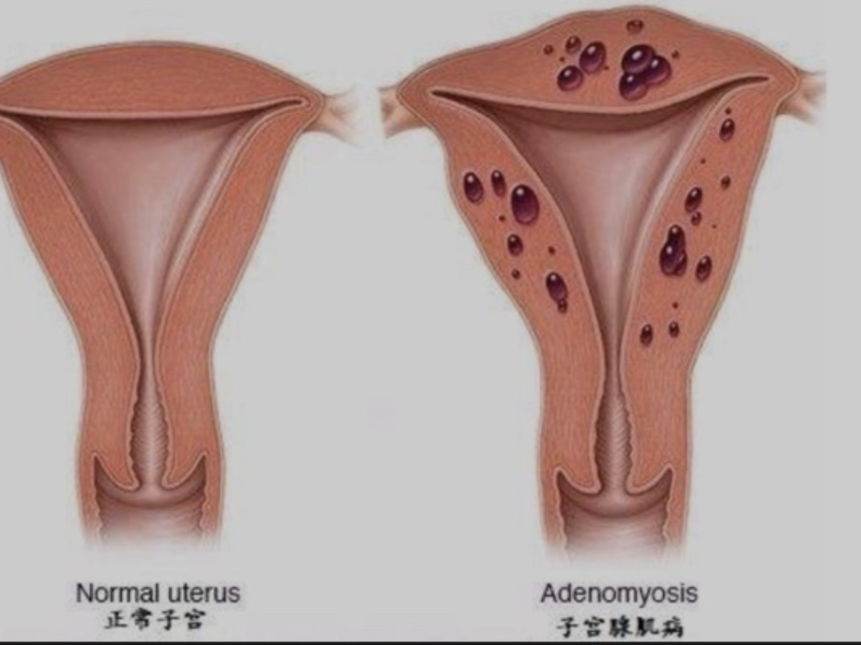 卵巢就是女性的青春之本,生命之源,别看这两个卵巢只有脚指头大小,卵