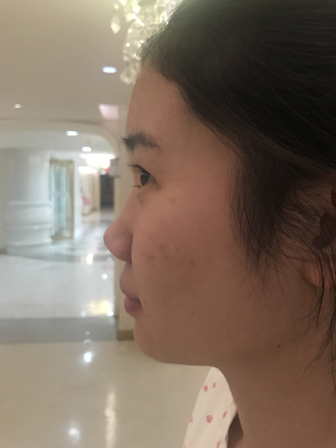 我我的鼻子在没做之前是非常难看的比量,他鼻子扁平显_圈子-新氧美容