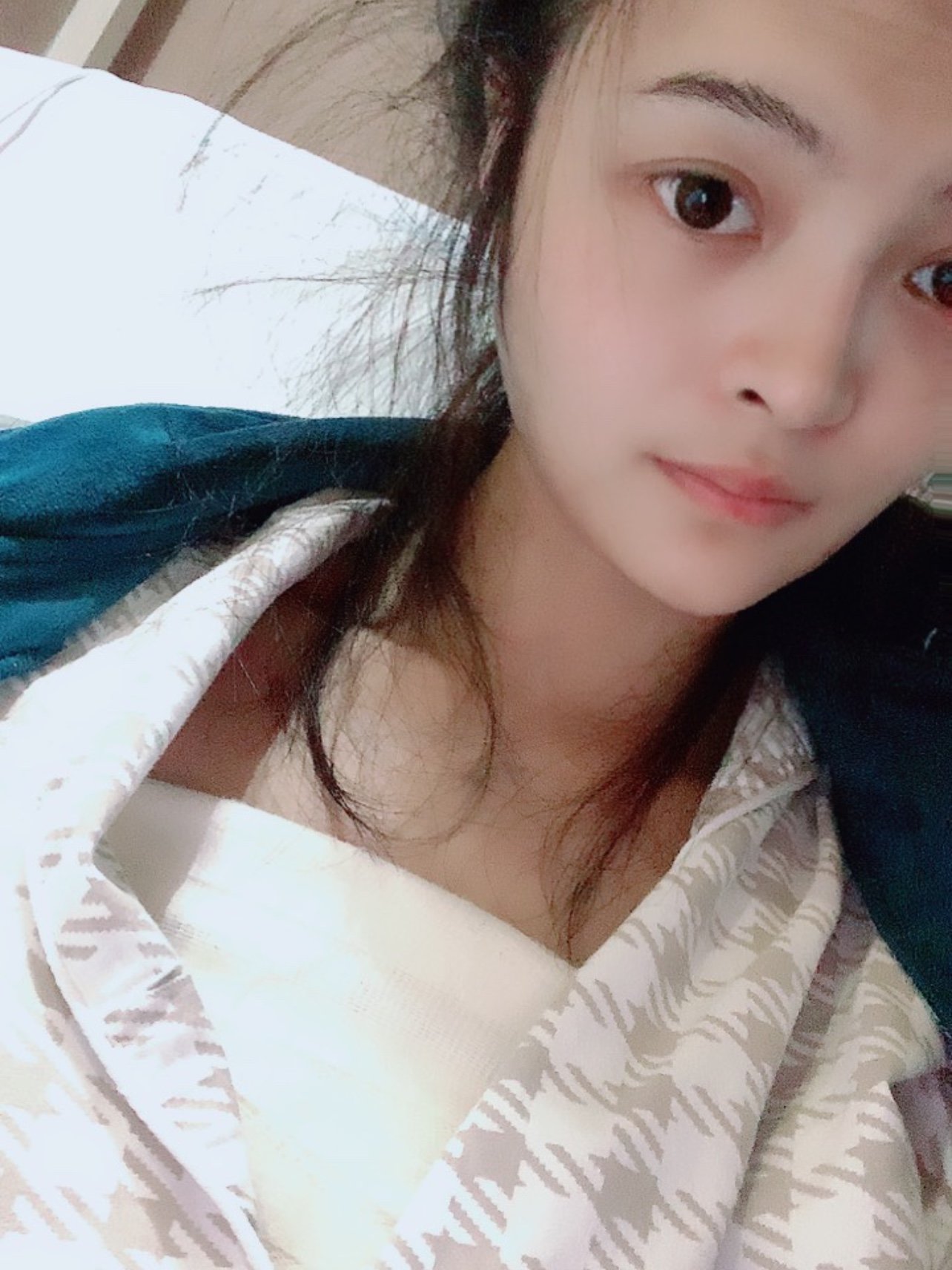 效果情况:傲若拉闪耀假体隆胸9月30号手术,平胸这_圈子-新氧美容整形
