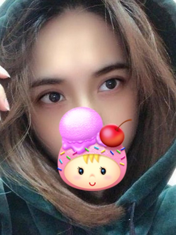 做的双眼皮能自然到什么程度 朱燕 北京华悦府医疗美容 5400