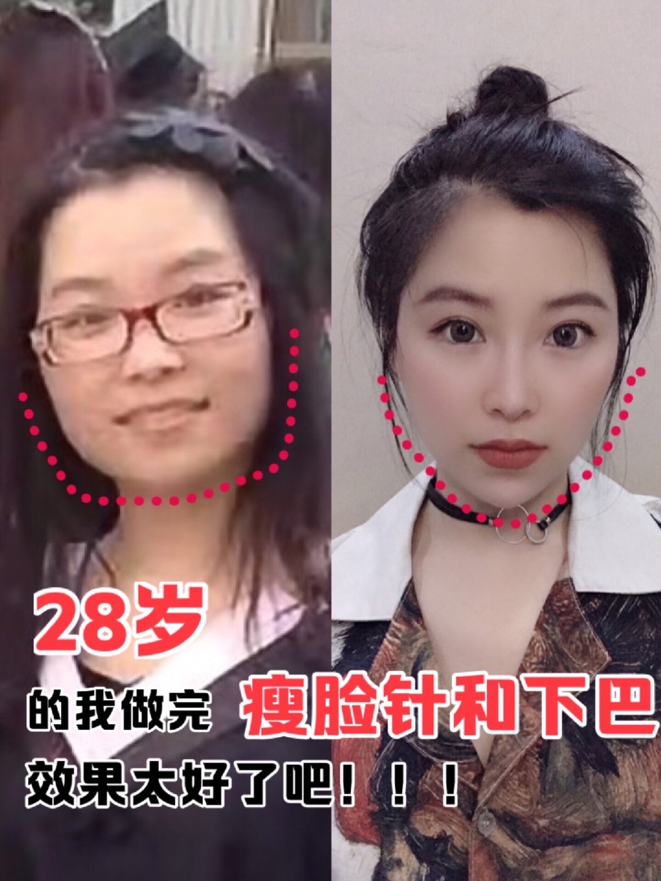 0707我的原生脸型属于上窄下宽的葫芦脸98在大众审美中_圈子