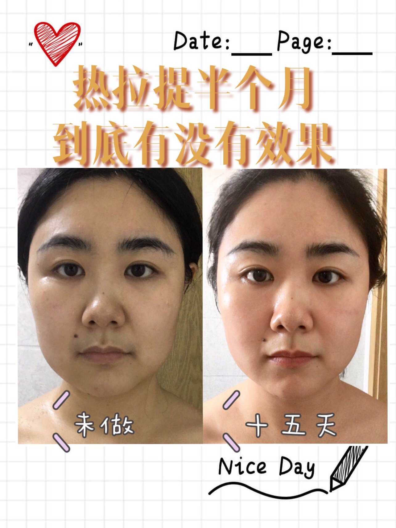 热拉提07十五天效果对比