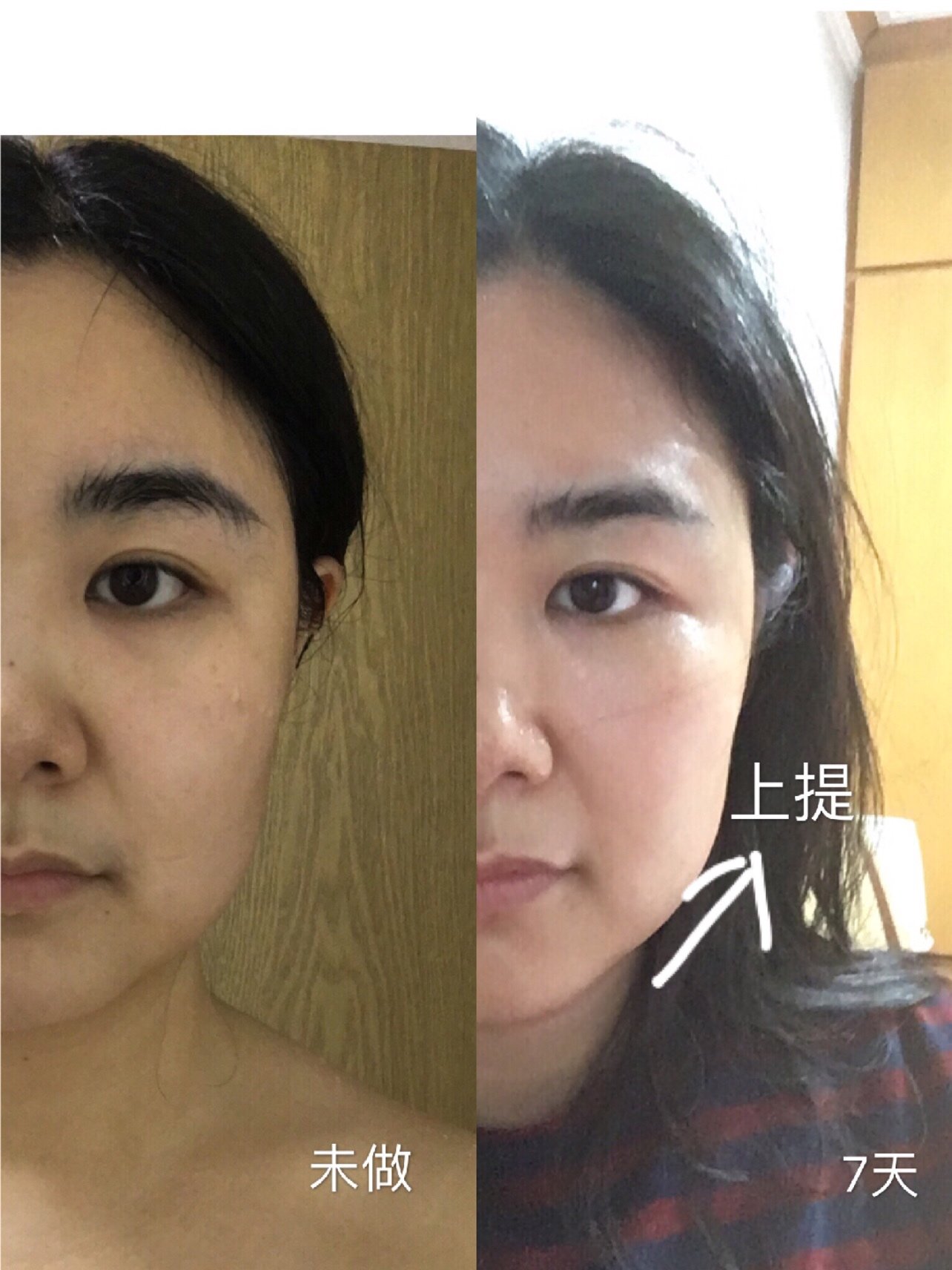 热拉提七天效果对比